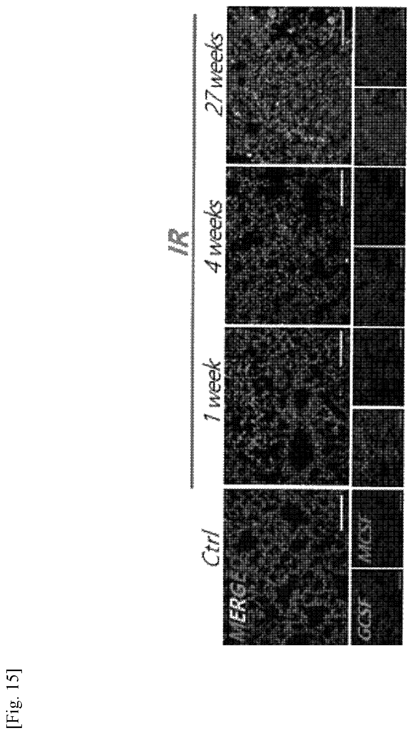 Patent US11787856 Figure 15 – Use of G-CSF antibody for treatment of pulmonary fibrosis