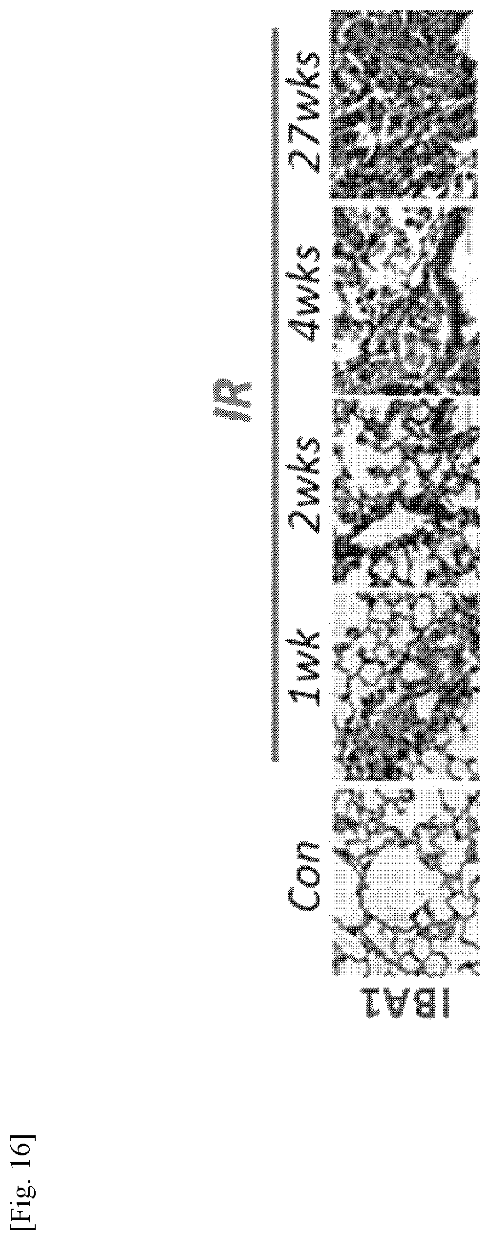 Patent US11787856 Figure 16 – Use of G-CSF antibody for treatment of pulmonary fibrosis