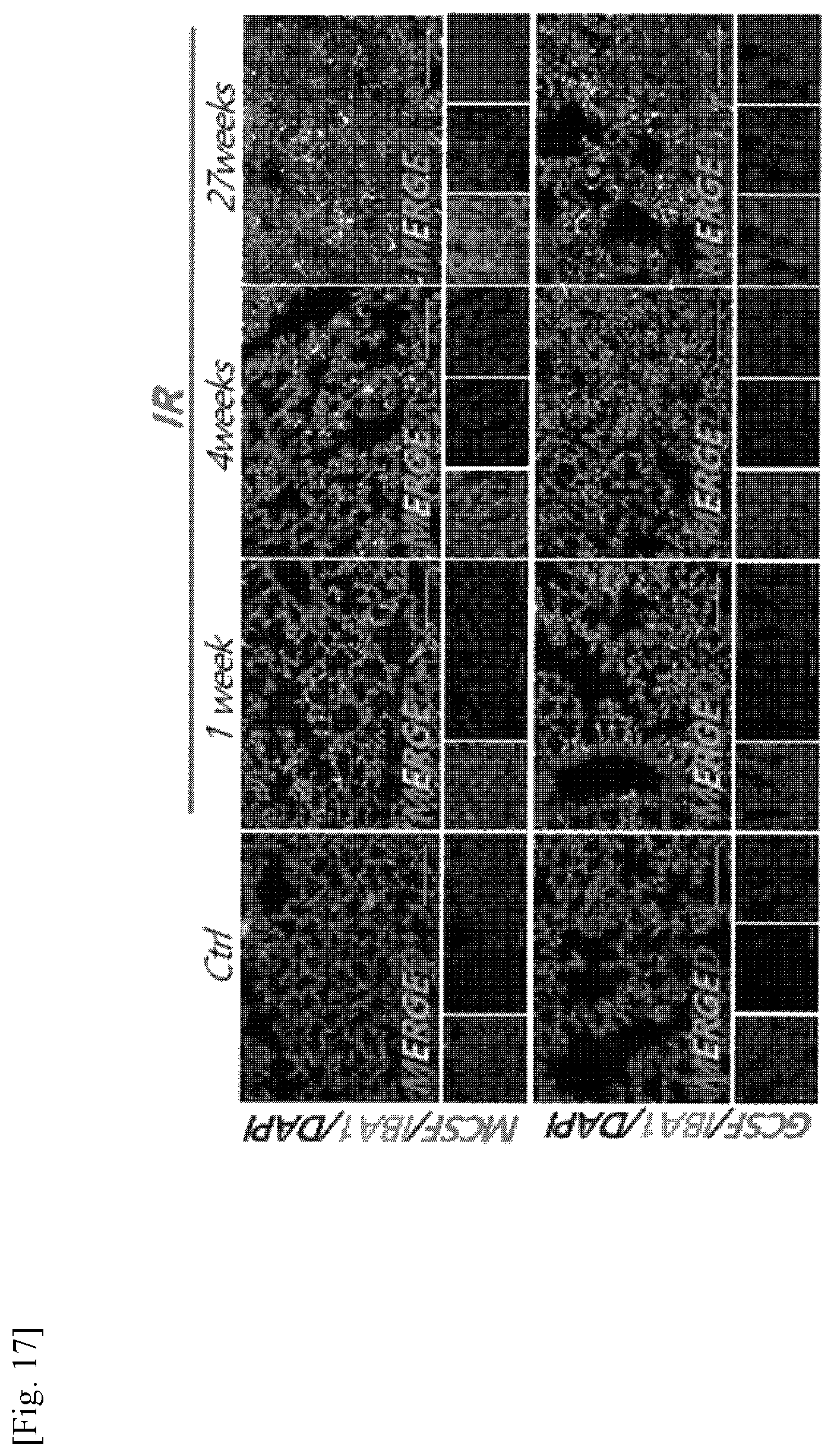 Patent US11787856 Figure 17 – Use of G-CSF antibody for treatment of pulmonary fibrosis