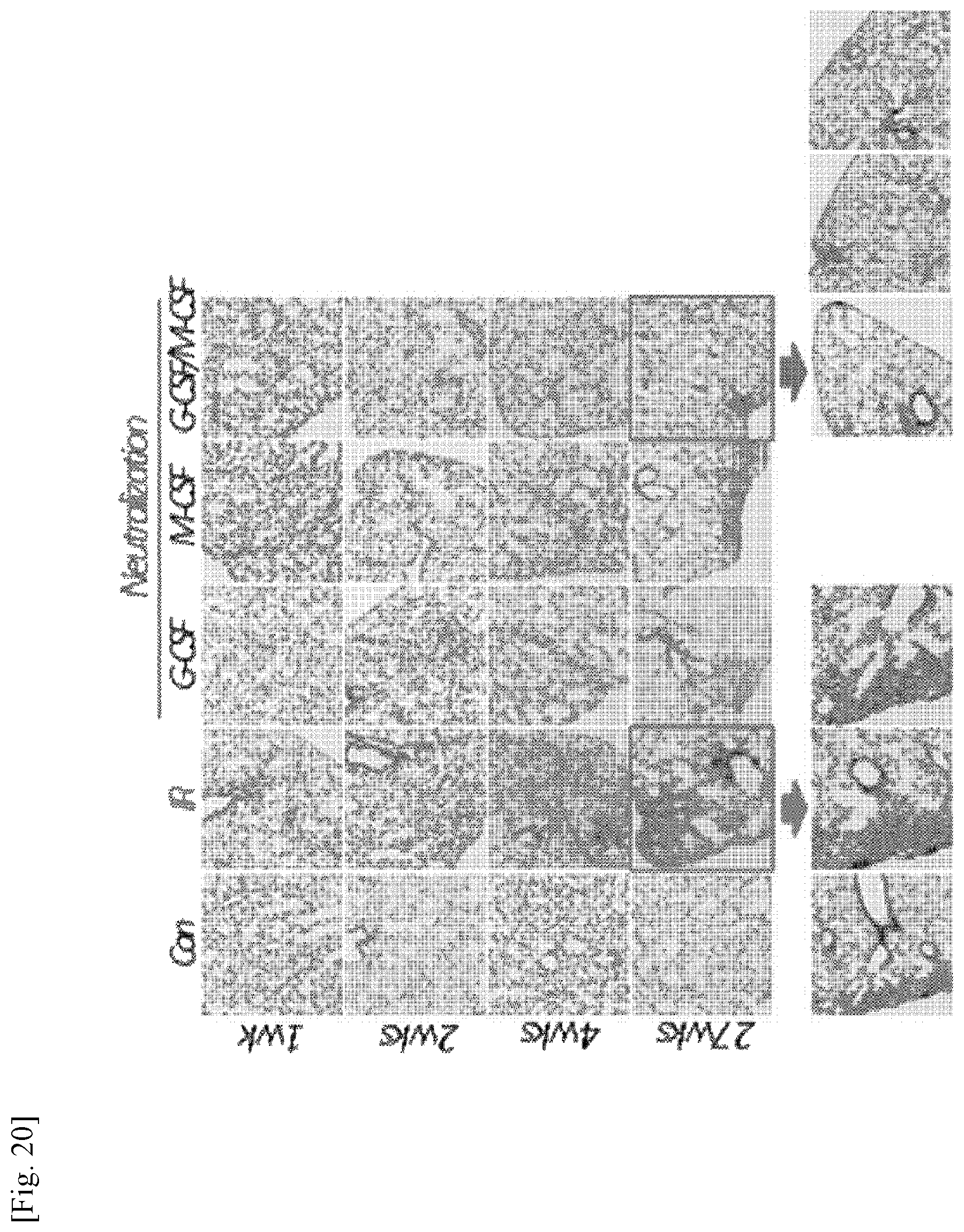 Patent US11787856 Figure 20 – Use of G-CSF antibody for treatment of pulmonary fibrosis