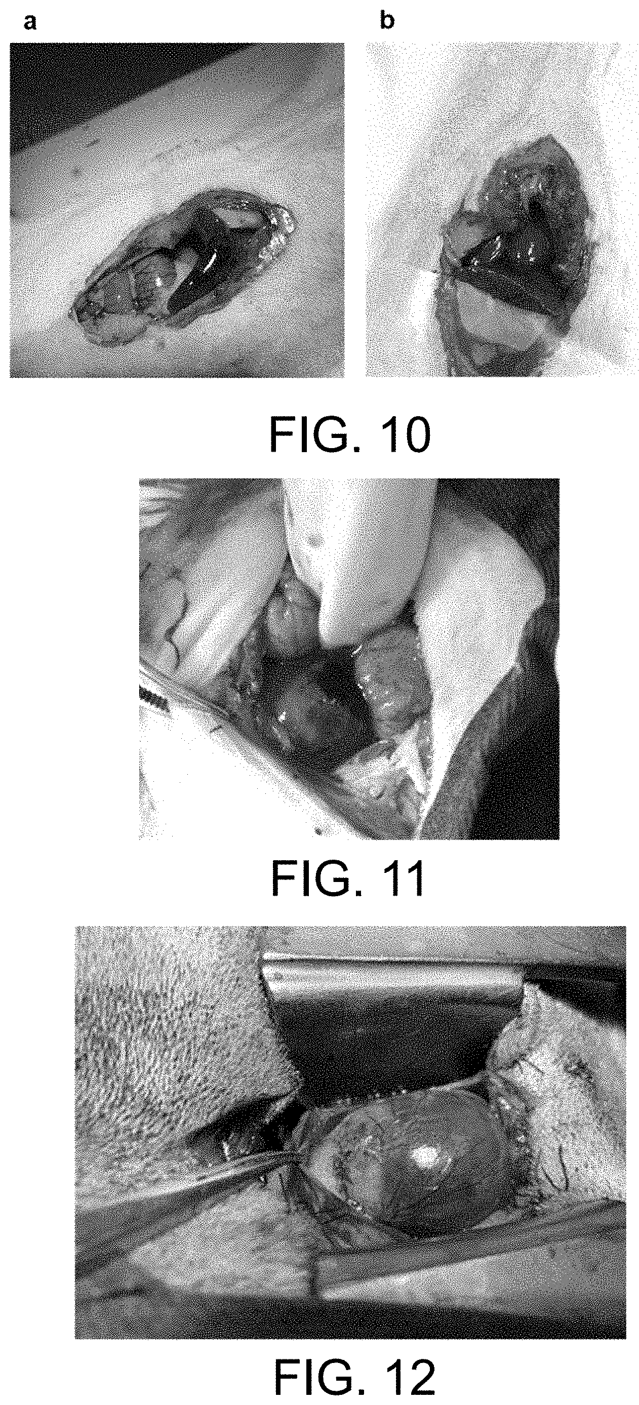 Patent US11787903 Figure 7 – Highly strong and tough photo-crosslinked hydrogel material and its preparation and application
