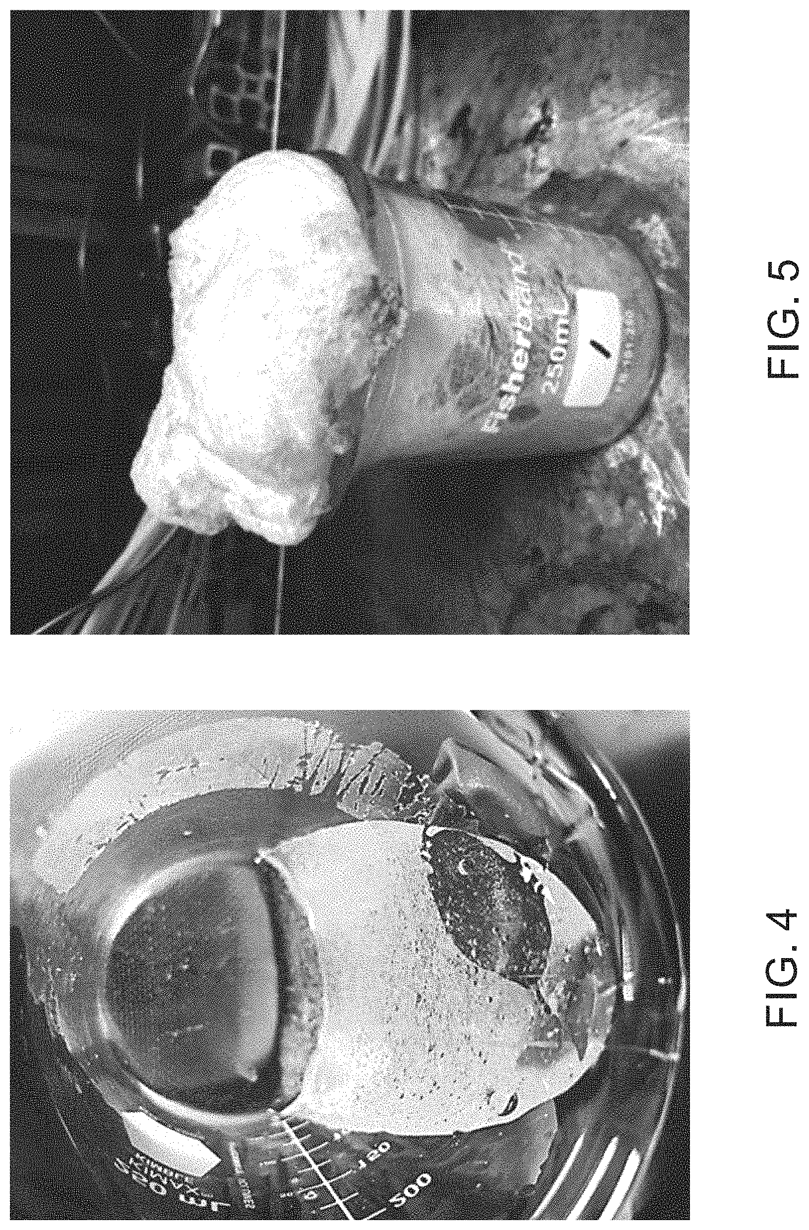 Patent US11787993 Figure 4 – In-situ foamed gel for lost circulation