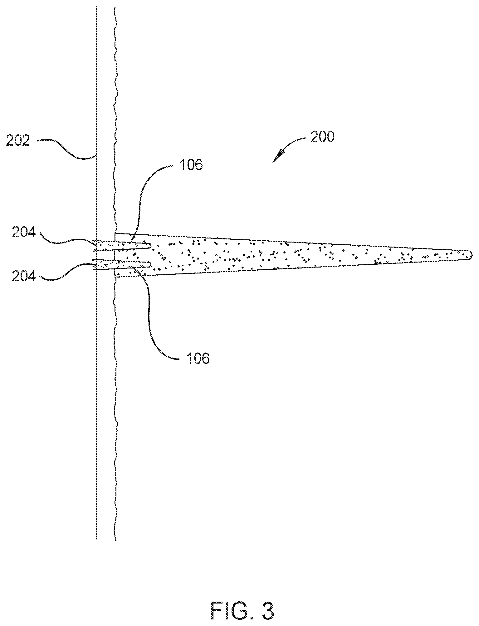 Patent US11787994 Figure 3 – Method of using composite diversion particle agglomerations