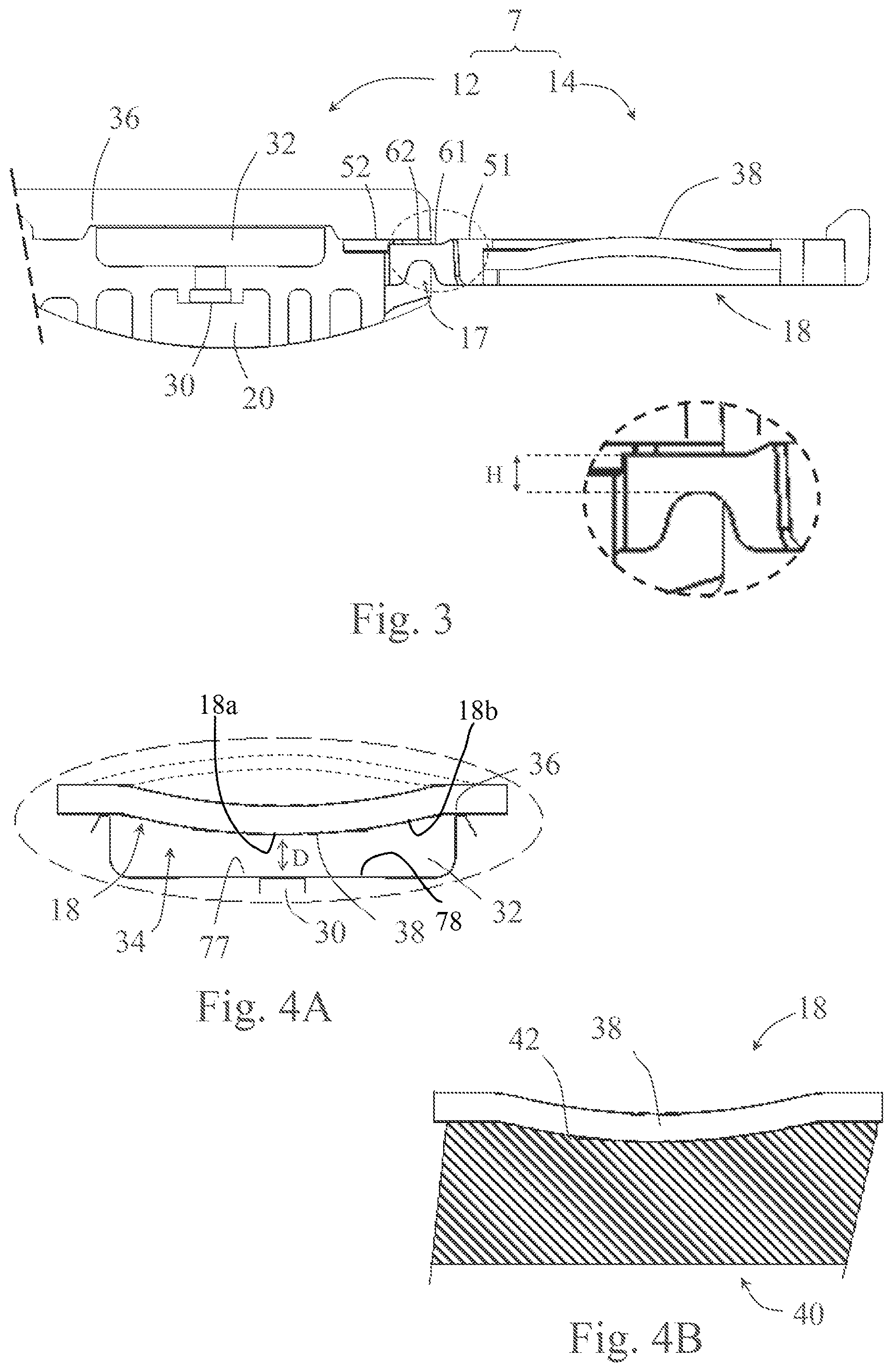Patent US11793127 Figure 2 – Drip emitter having membrane with a non-planar portion protruding into regulating chamber recess