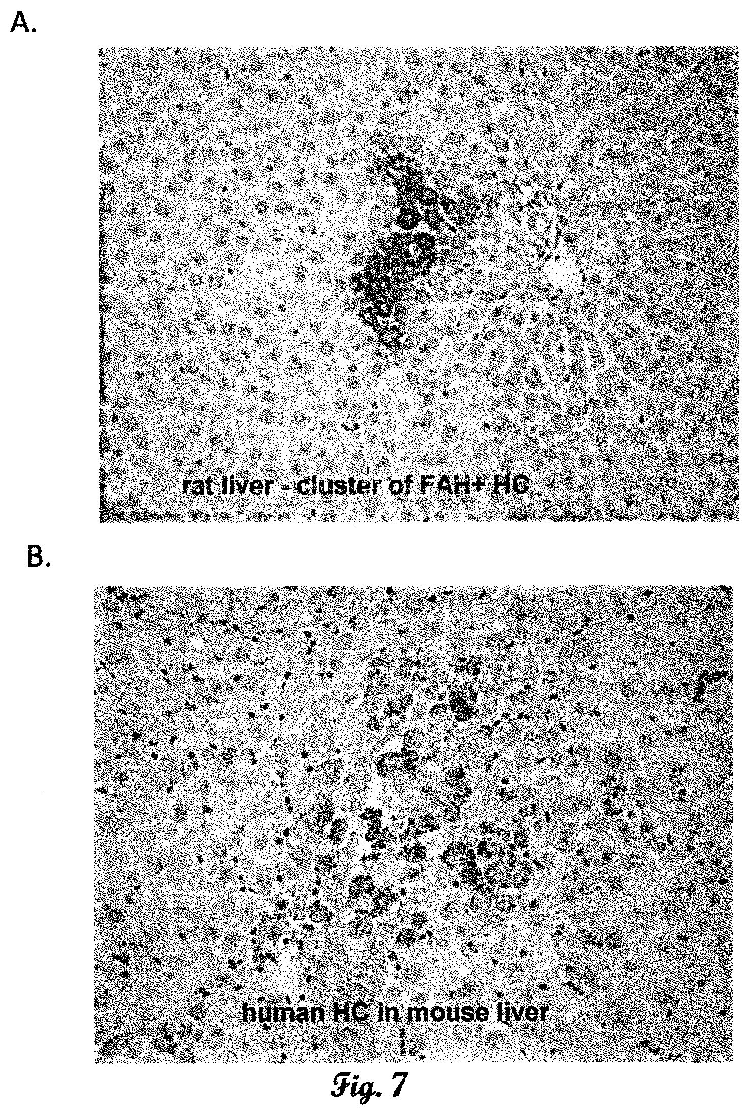 Patent US11793178 Figure 4 – Fumarylacetoacetate hydrolase (FAH)-deficient and immunodeficient rats and uses thereof