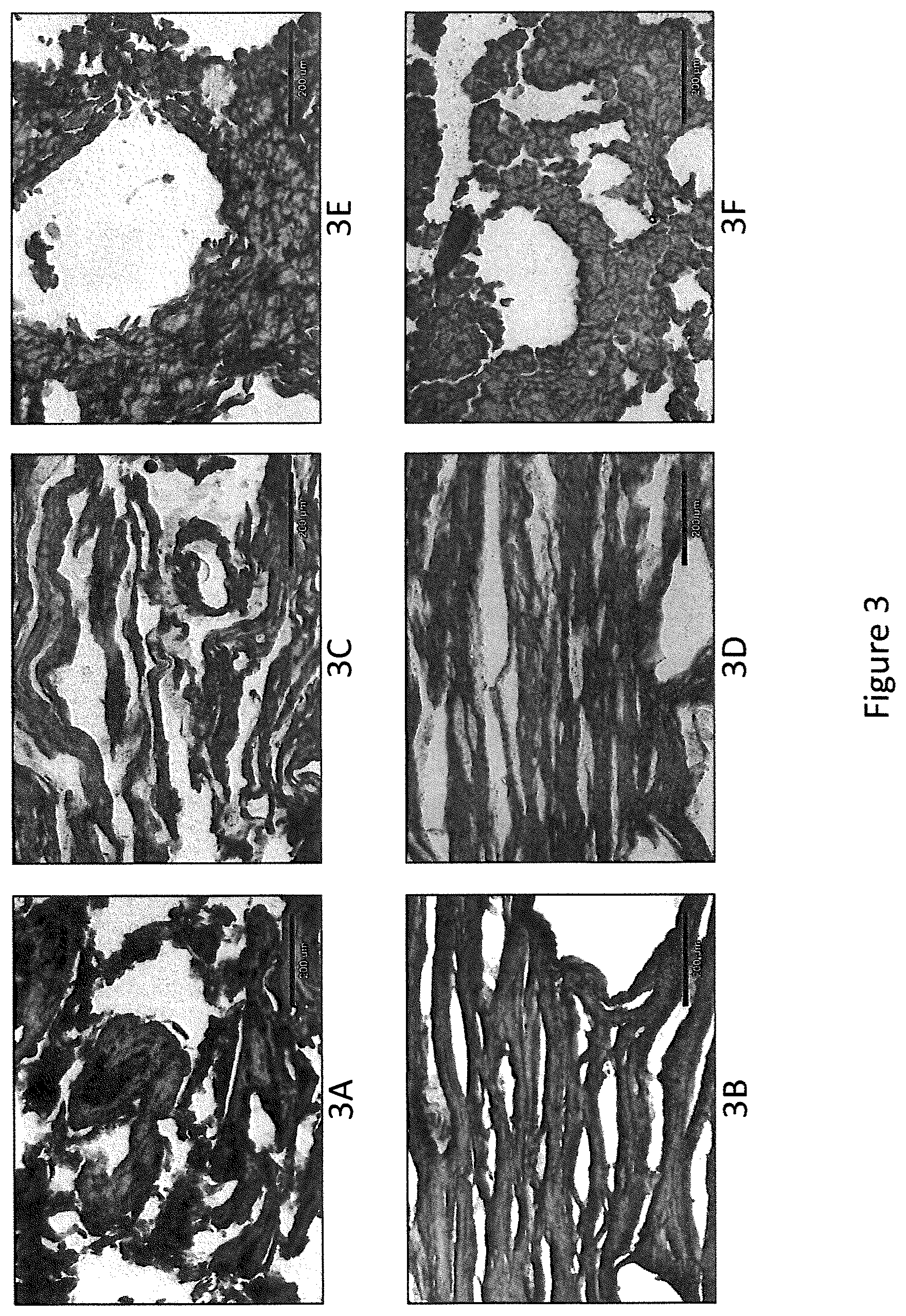 Patent US11793214 Figure 3 – Extruded protein product and methods of making
