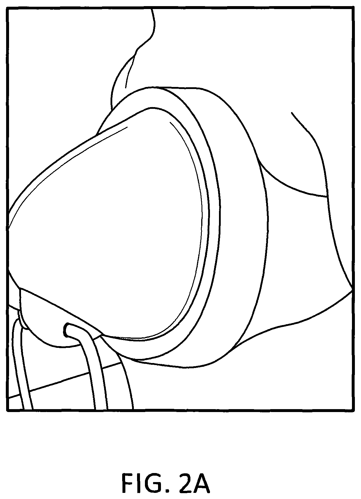 Patent US11793245 Figure 3 – Brassiere with slidable rims