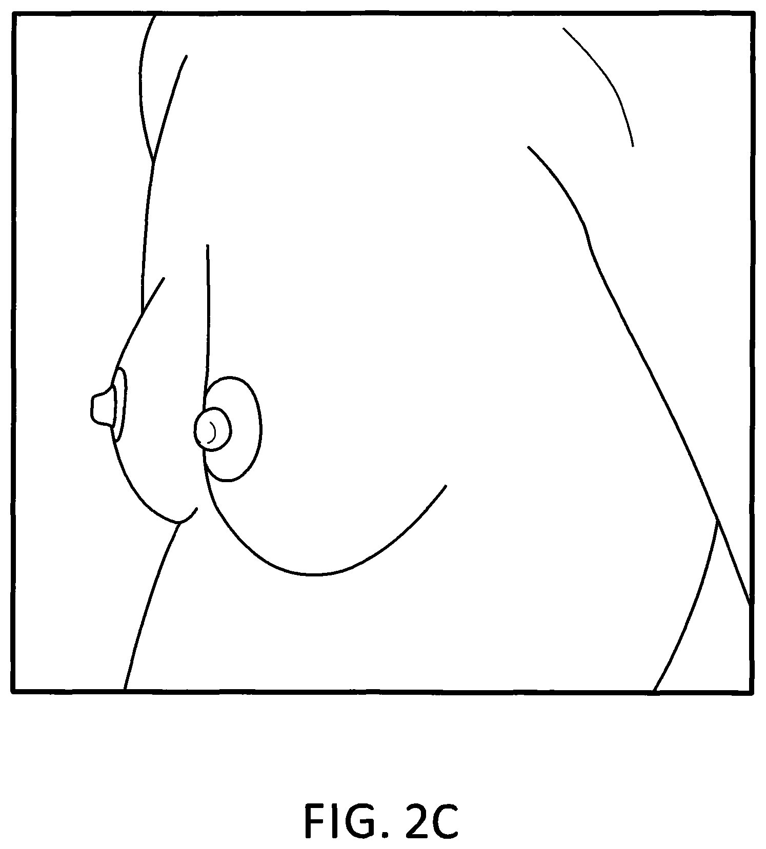 Patent US11793245 Figure 5 – Brassiere with slidable rims