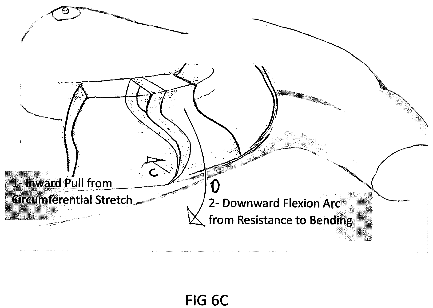 Patent US11793245 Figure 10 – Brassiere with slidable rims
