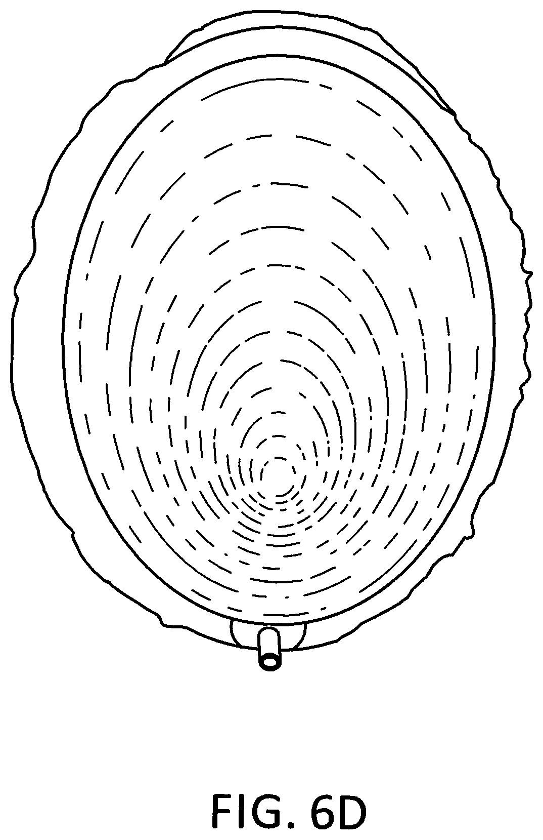 Patent US11793245 Figure 11 – Brassiere with slidable rims