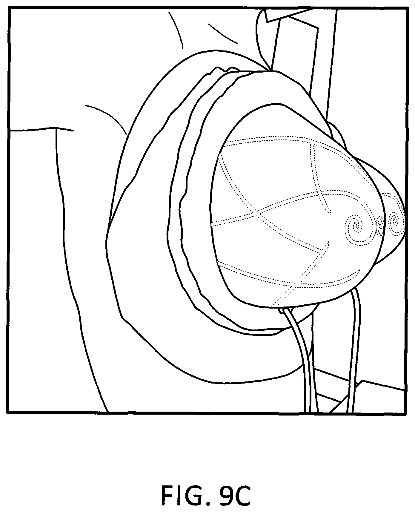 Patent US11793245 Figure 18 – Brassiere with slidable rims