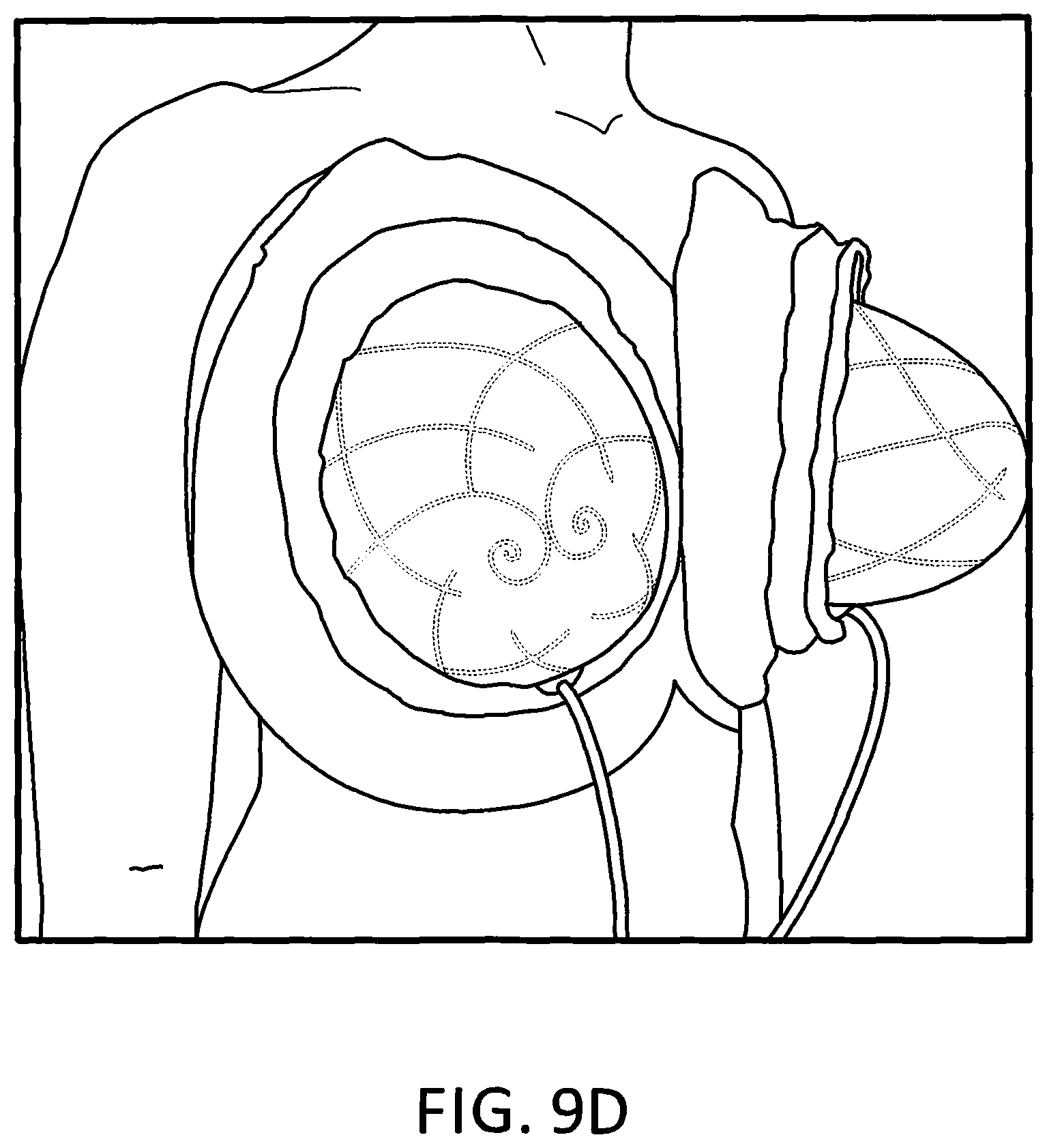 Patent US11793245 Figure 19 – Brassiere with slidable rims