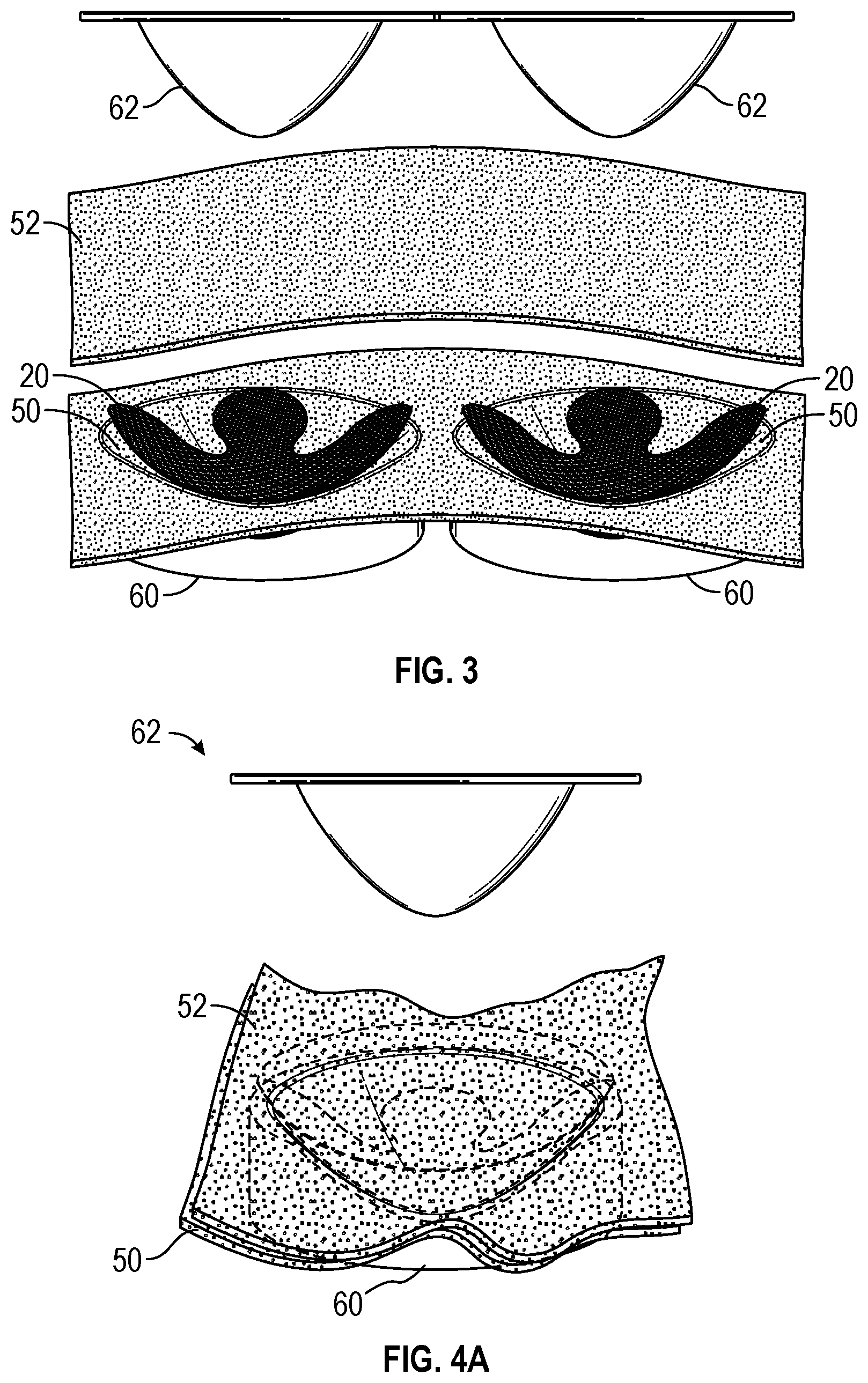Patent US11793246 Figure 2 – Brassiere and associated method of manufacture