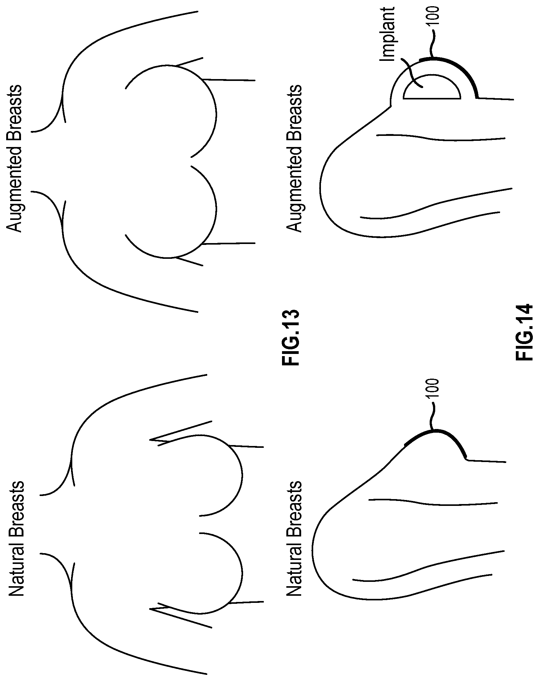 Patent US11793246 Figure 10 – Brassiere and associated method of manufacture