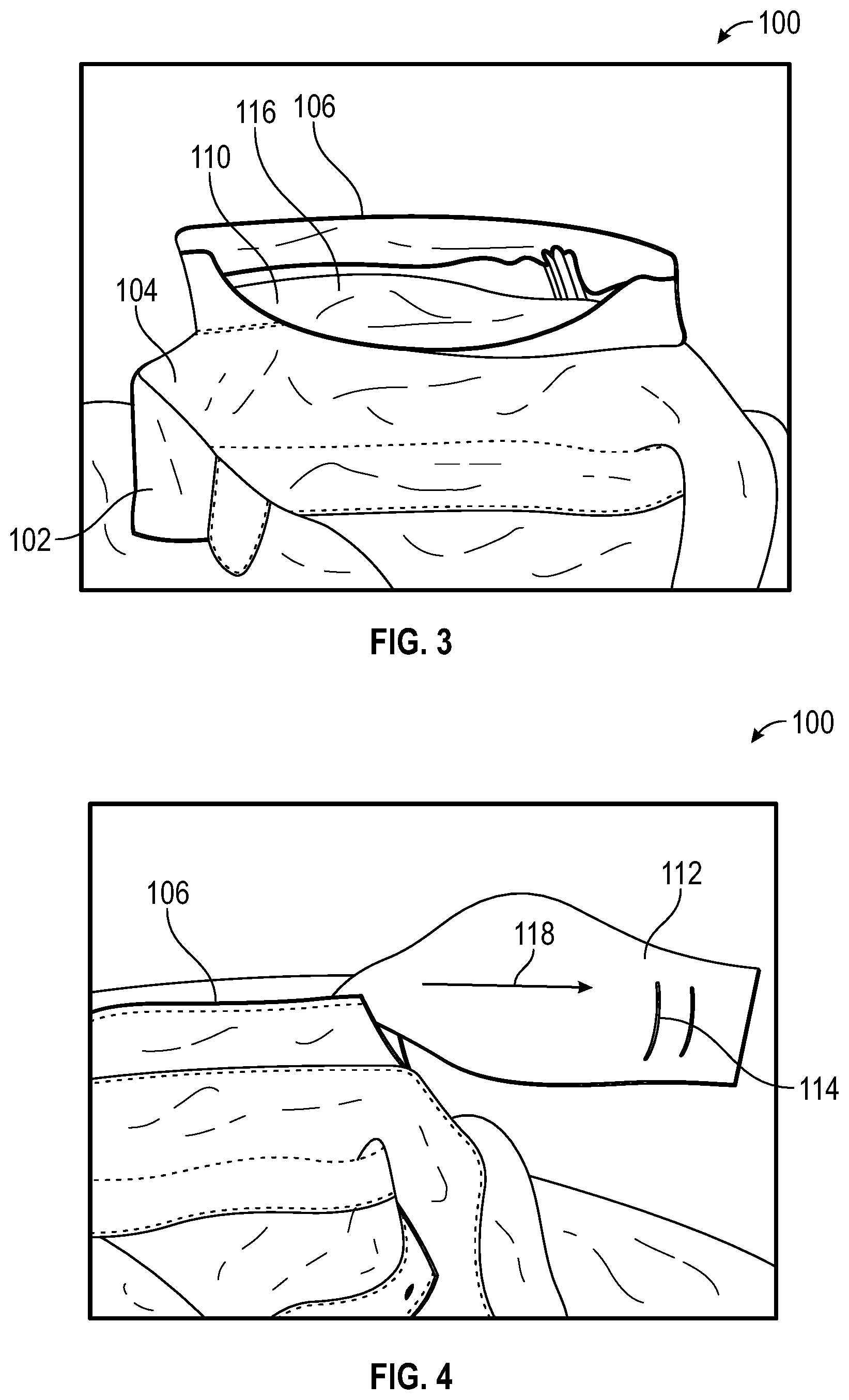 Patent US11793252 Figure 2 – Collared garment with concealed deployable face mask