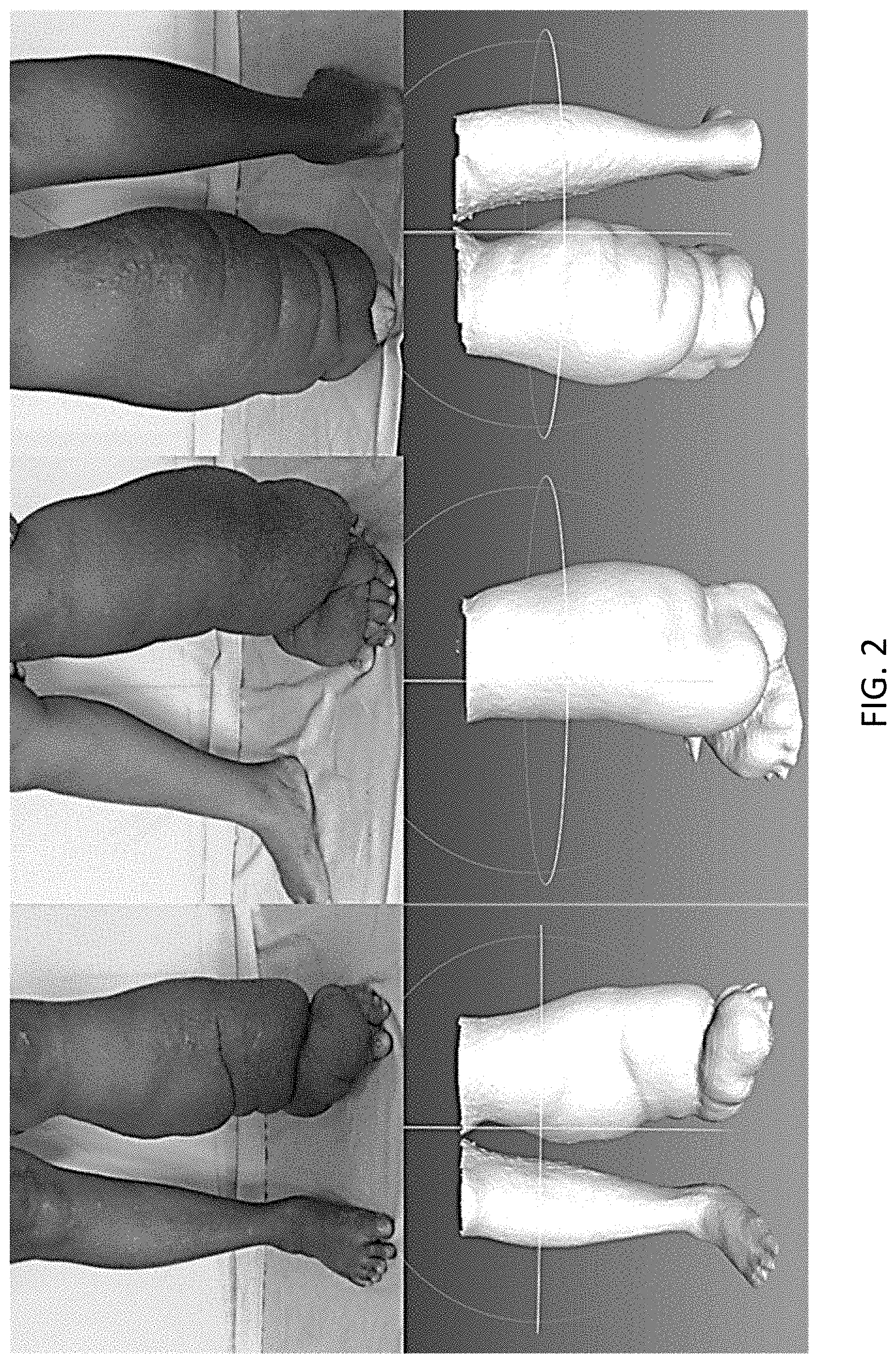 Patent US11793256 Figure 2 – Methods and systems of fitting, evaluating, and improving therapeutic compression garments