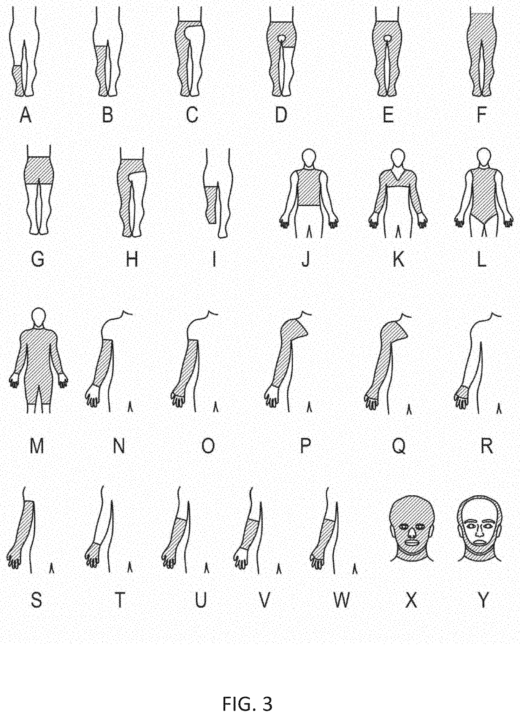 Patent US11793256 Figure 3 – Methods and systems of fitting, evaluating, and improving therapeutic compression garments