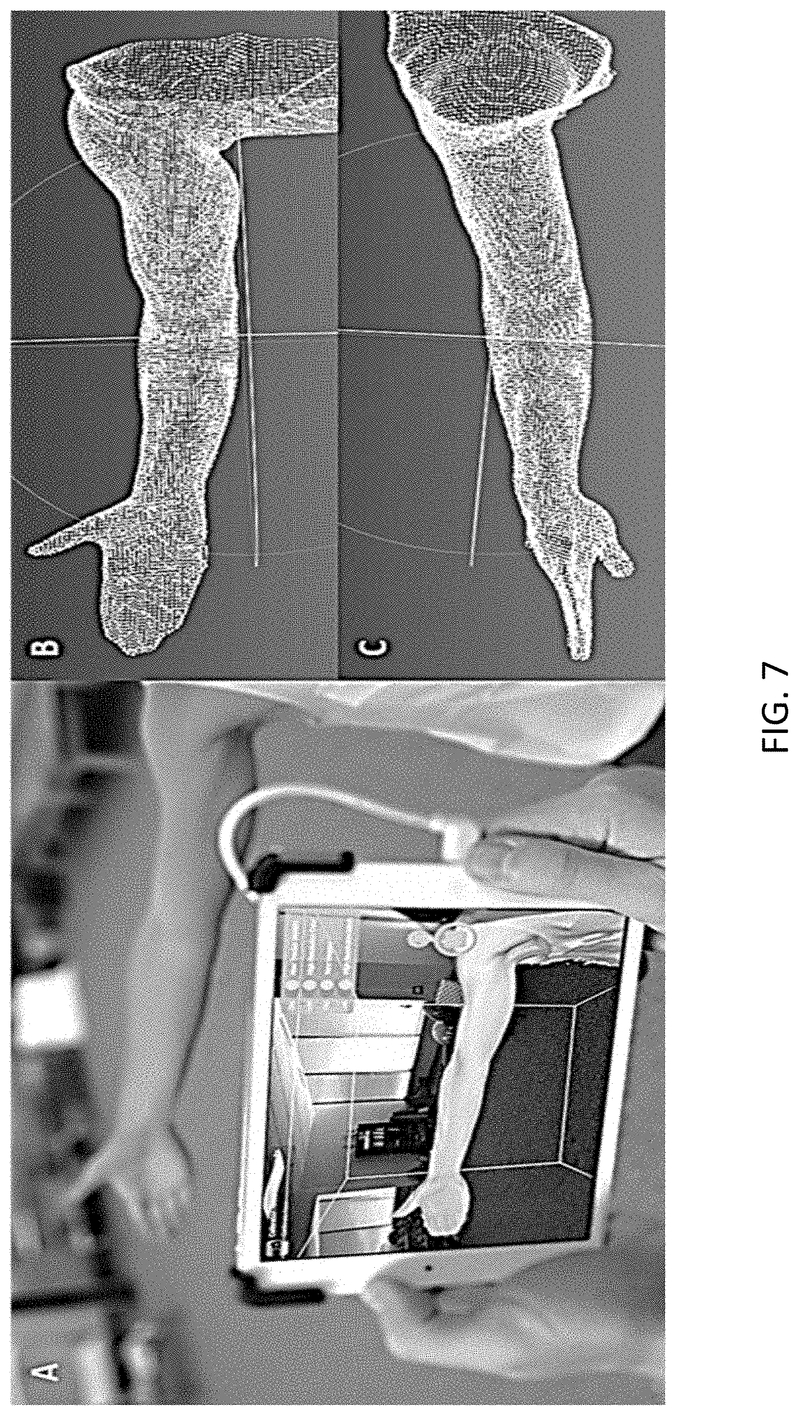 Patent US11793256 Figure 7 – Methods and systems of fitting, evaluating, and improving therapeutic compression garments