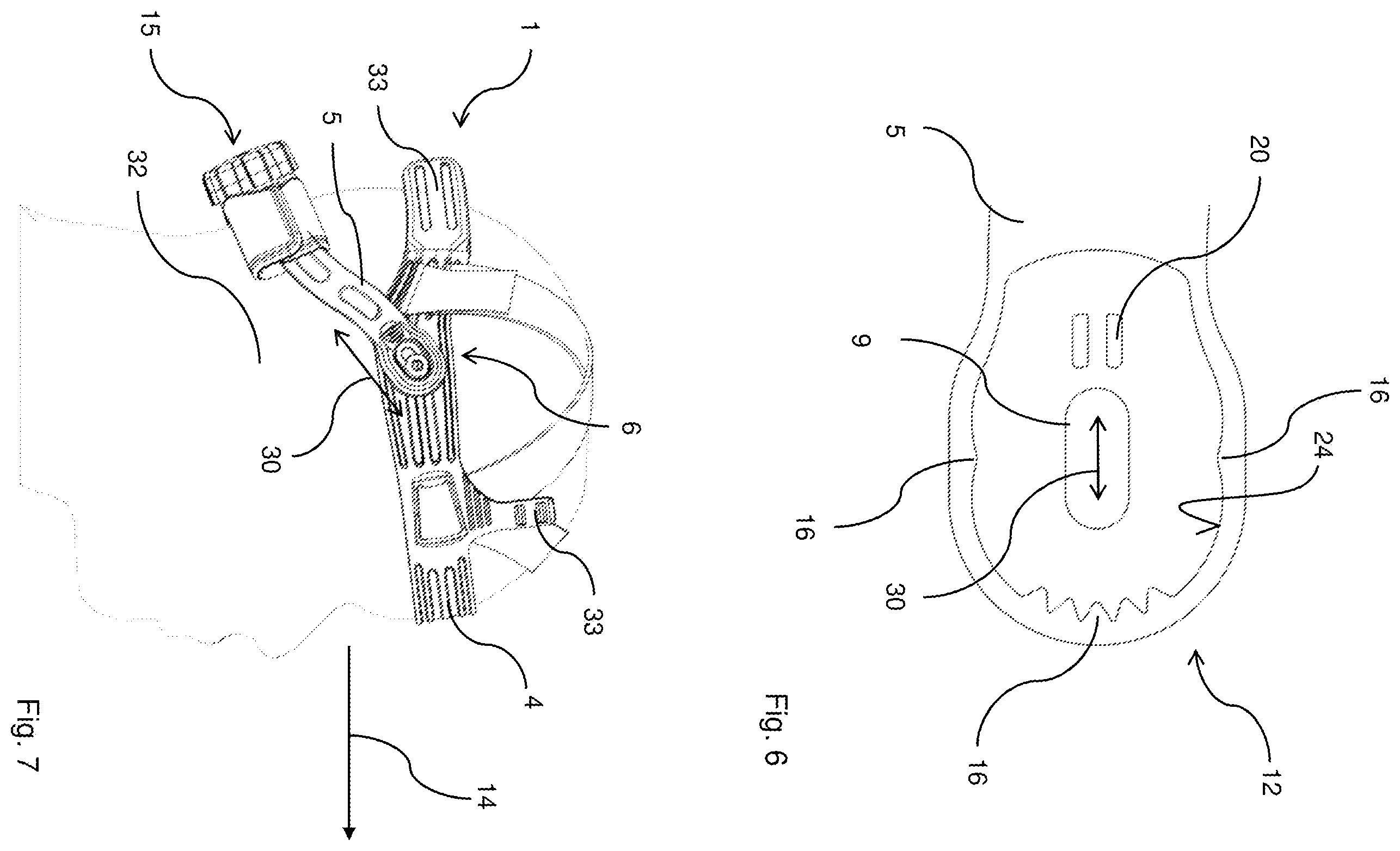 Patent US11793260 Figure 4 – Skull mounting system for headgear, respiratory hood with headgear and method for fastening of headgear