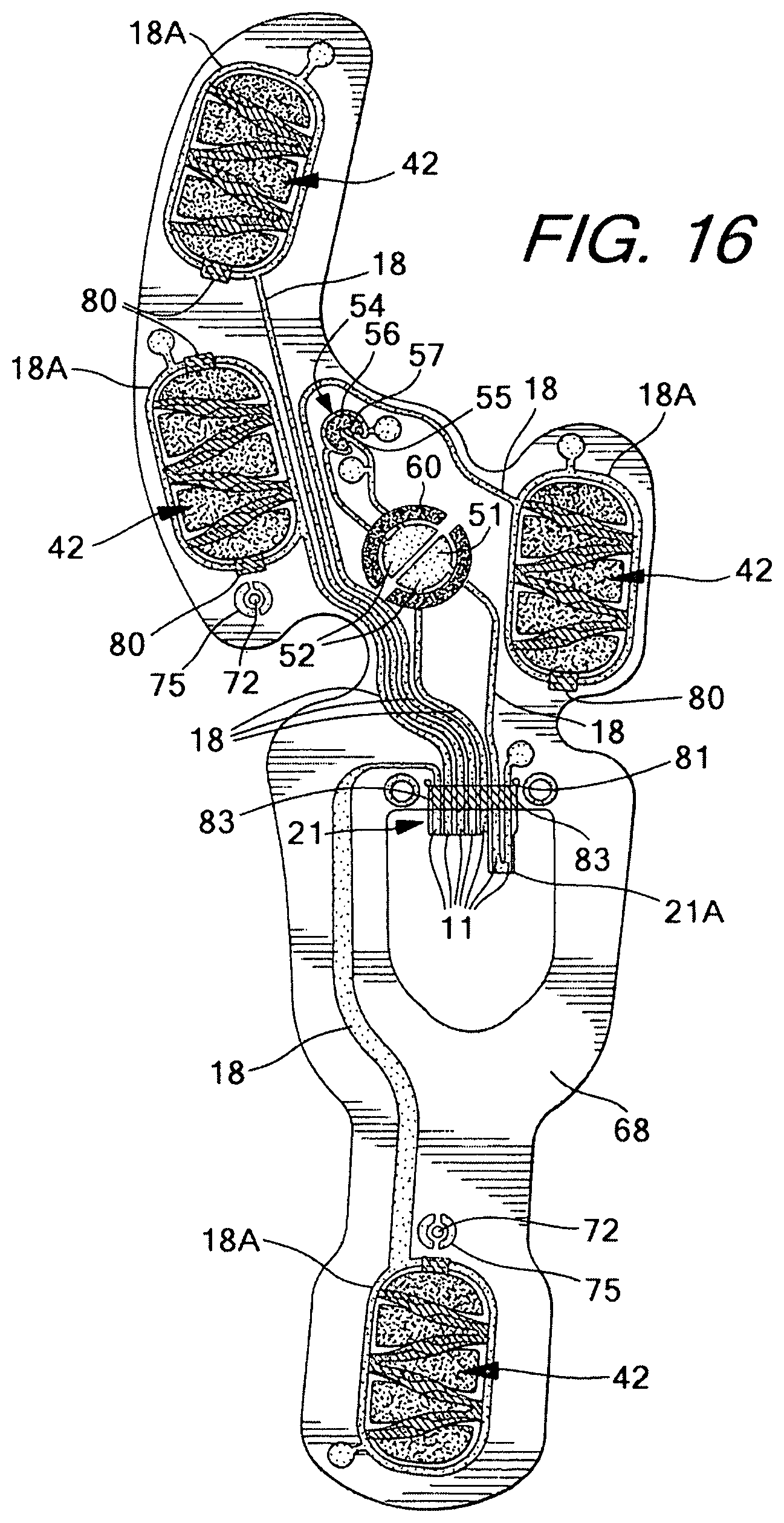 Patent US11793264 Figure 15 – Footwear having sensor system
