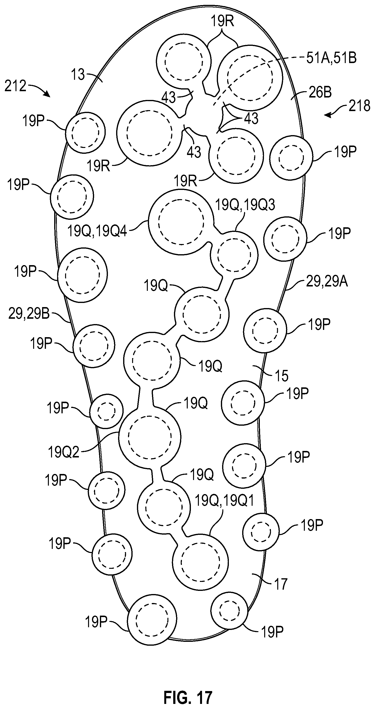 Patent US11793271 Figure 11 – Midsole system with graded response
