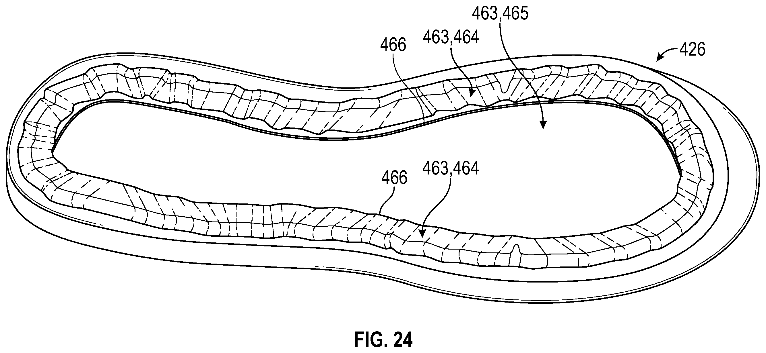 Patent US11793271 Figure 15 – Midsole system with graded response