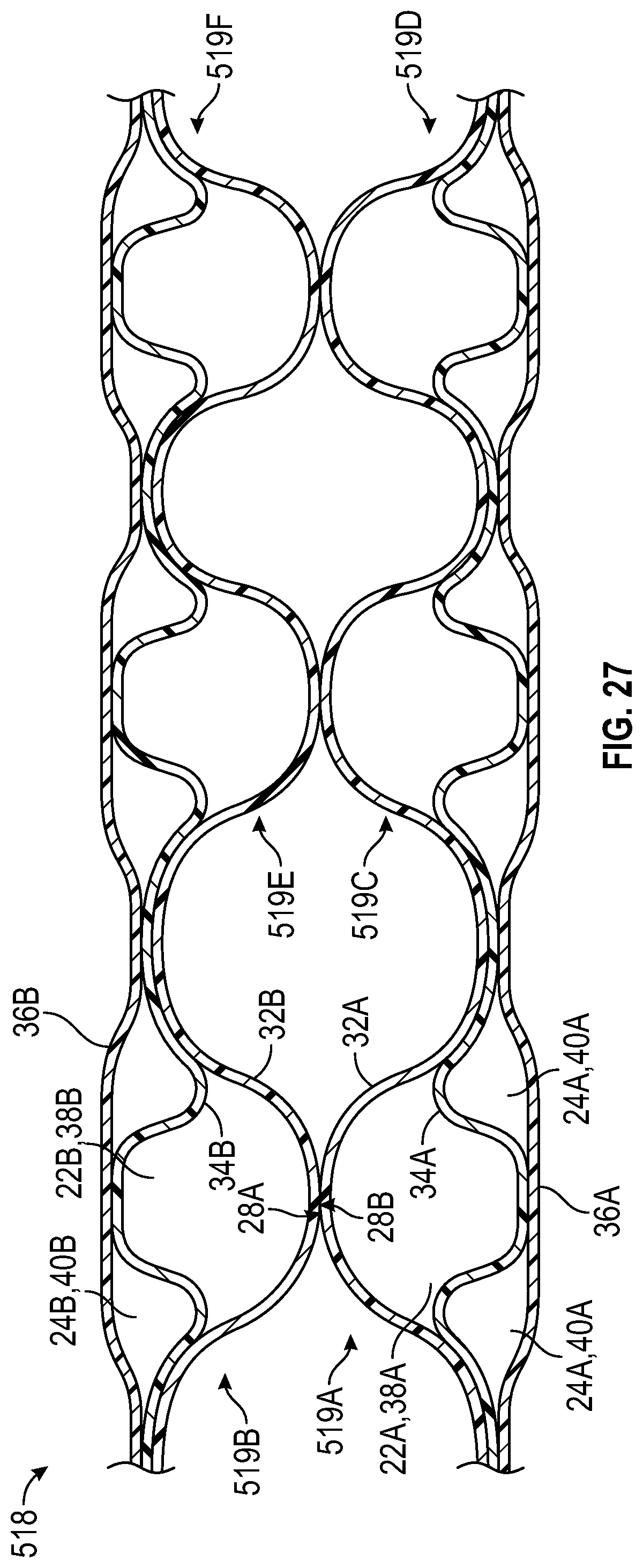 Patent US11793271 Figure 17 – Midsole system with graded response