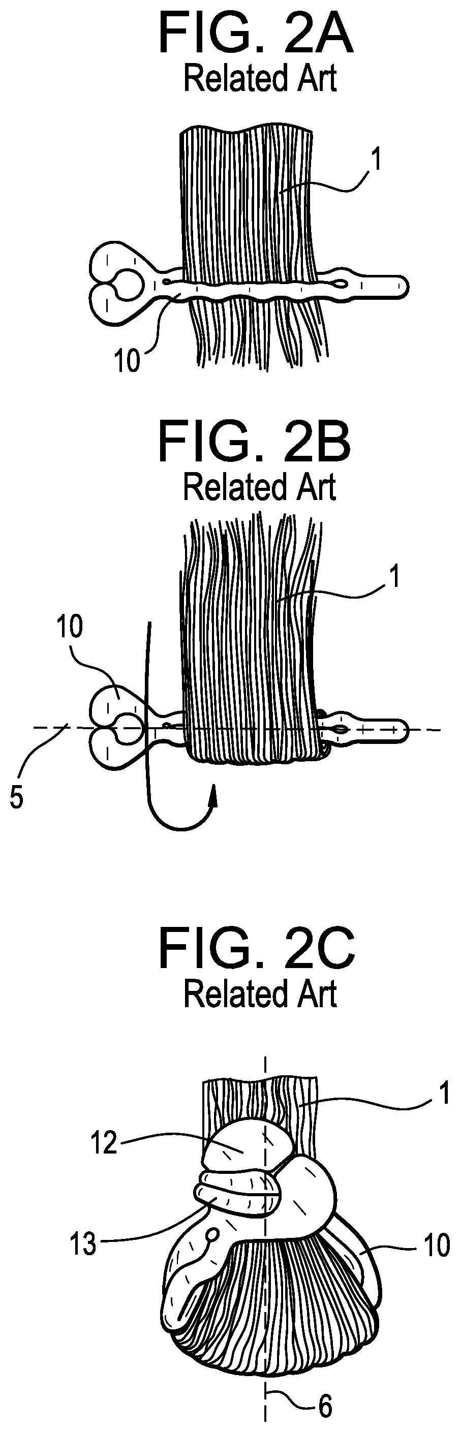 Patent US11793288 Figure 2 – Resilient fiber retainers and methods of externally wrapping and shaping fiber with the same