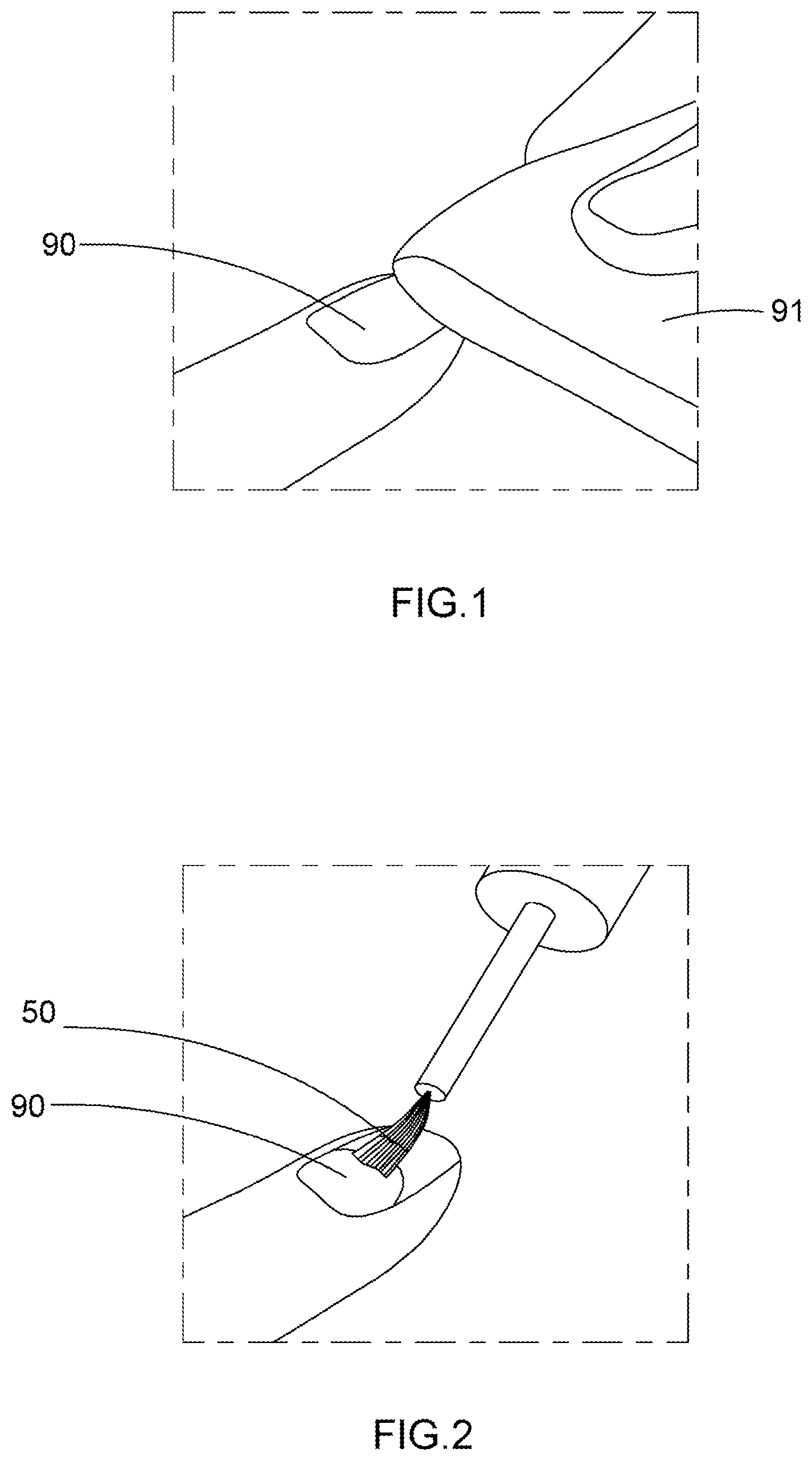 Patent US11793289 Figure 1 – Artificial nail tip and curing composition set and applying method thereof