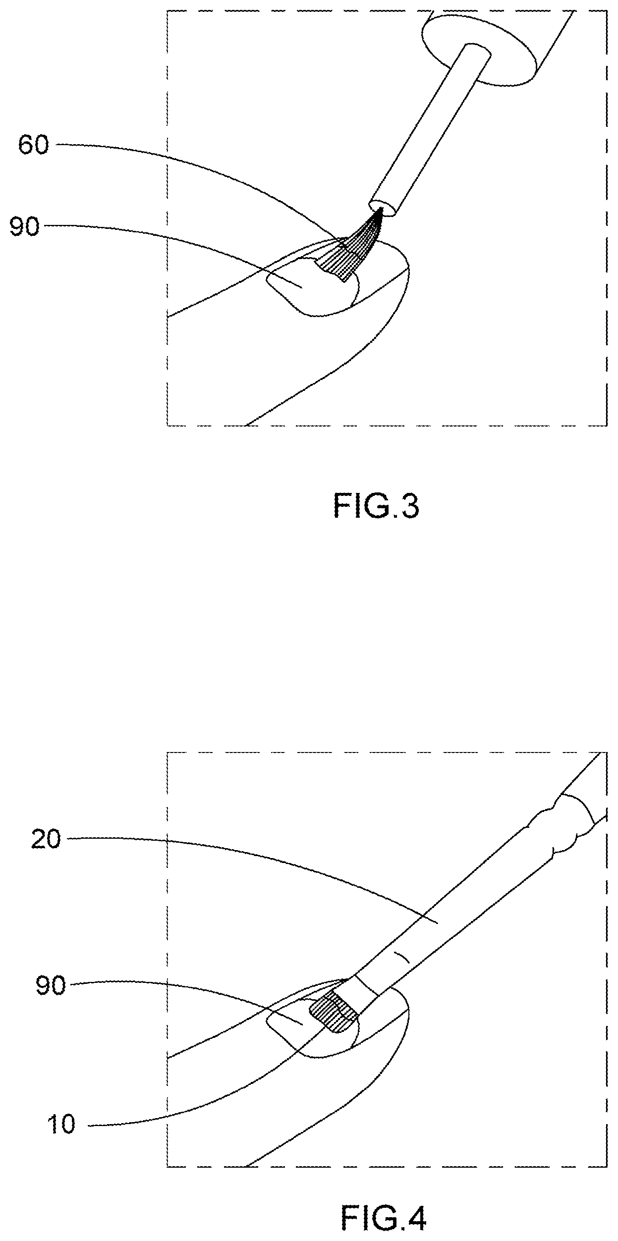 Patent US11793289 Figure 2 – Artificial nail tip and curing composition set and applying method thereof