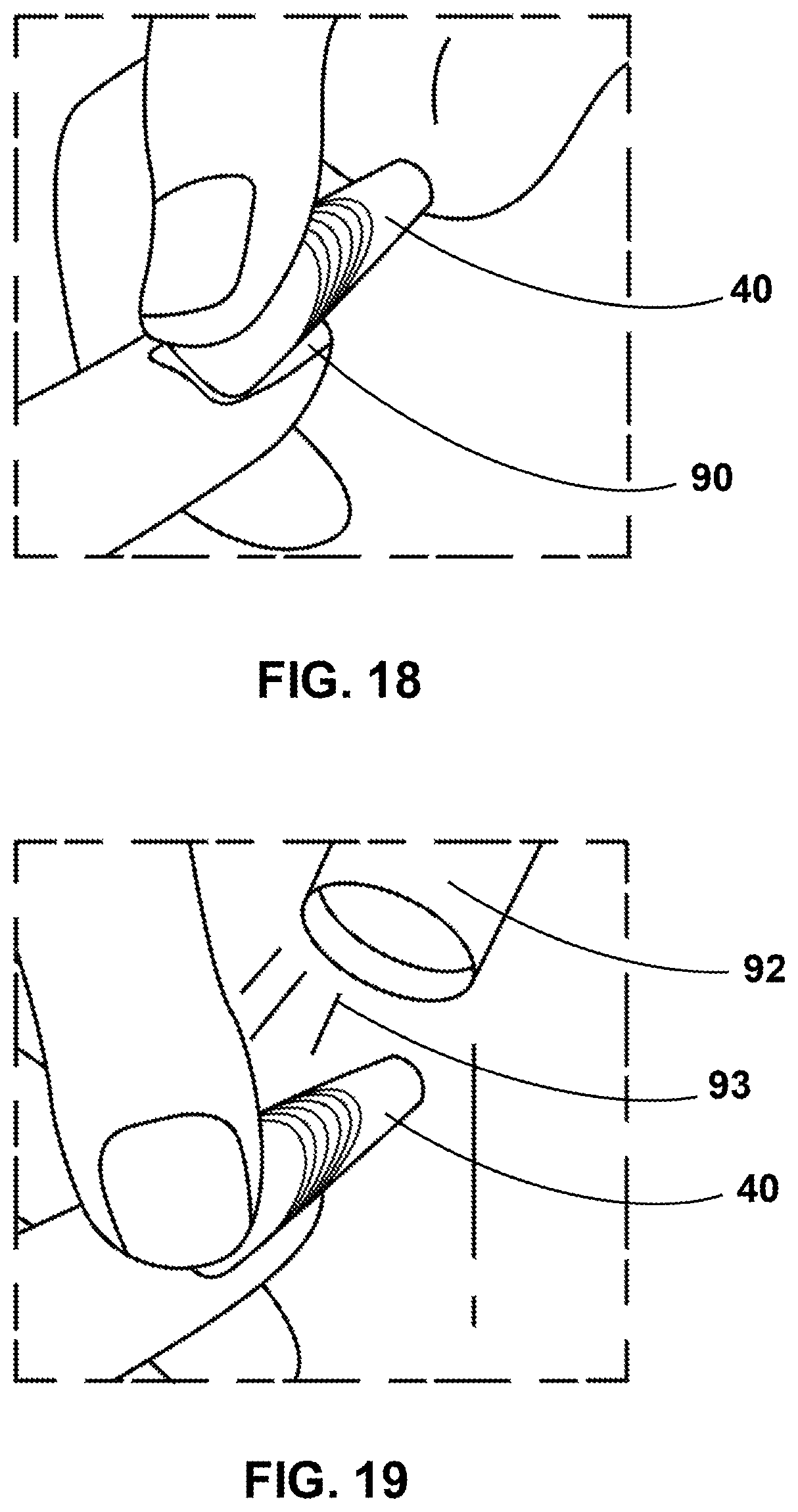 Patent US11793289 Figure 12 – Artificial nail tip and curing composition set and applying method thereof