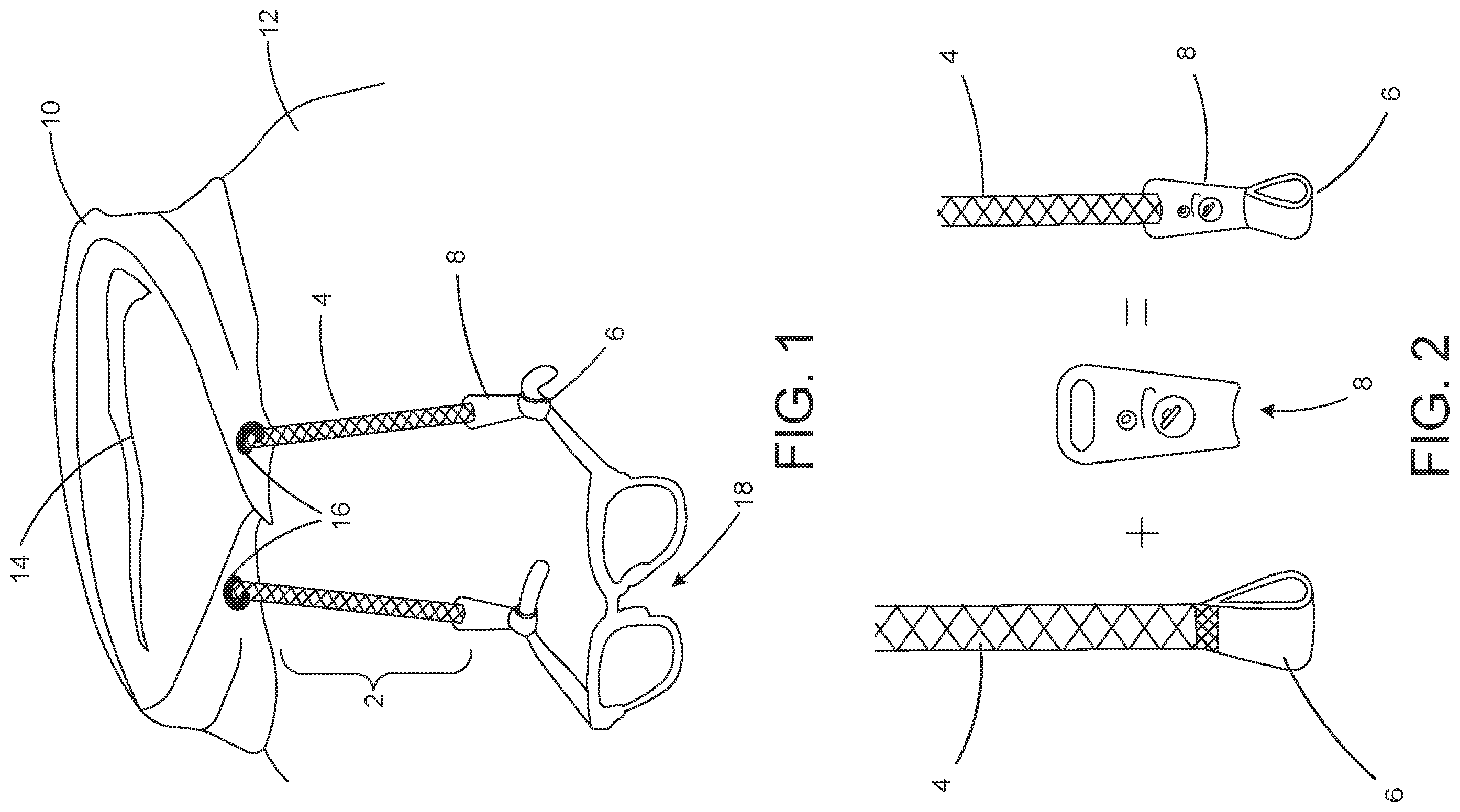 Patent US11793297 Figure 1 – Sensory-friendly eyewear holder
