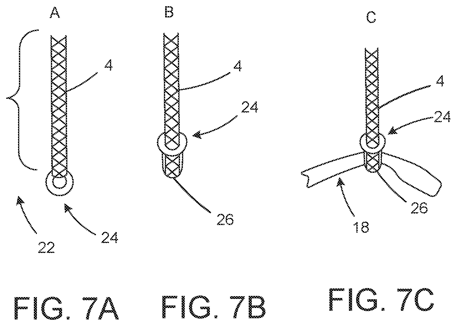 Patent US11793297 Figure 4 – Sensory-friendly eyewear holder