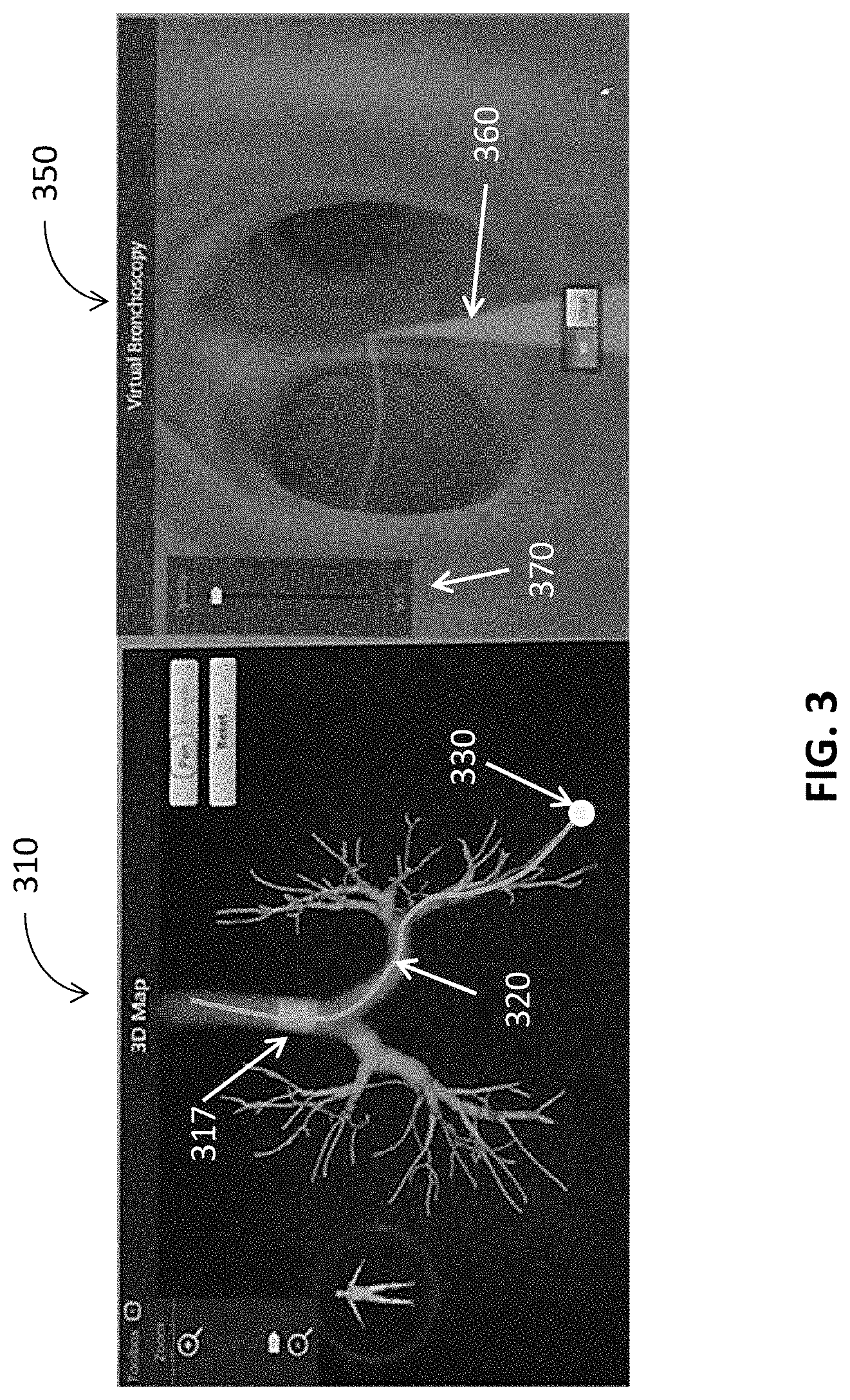 Patent US11793389 Figure 3 – Intelligent display