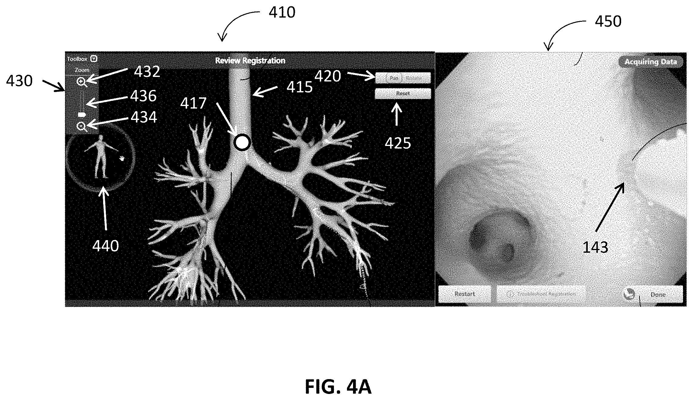 Patent US11793389 Figure 4 – Intelligent display