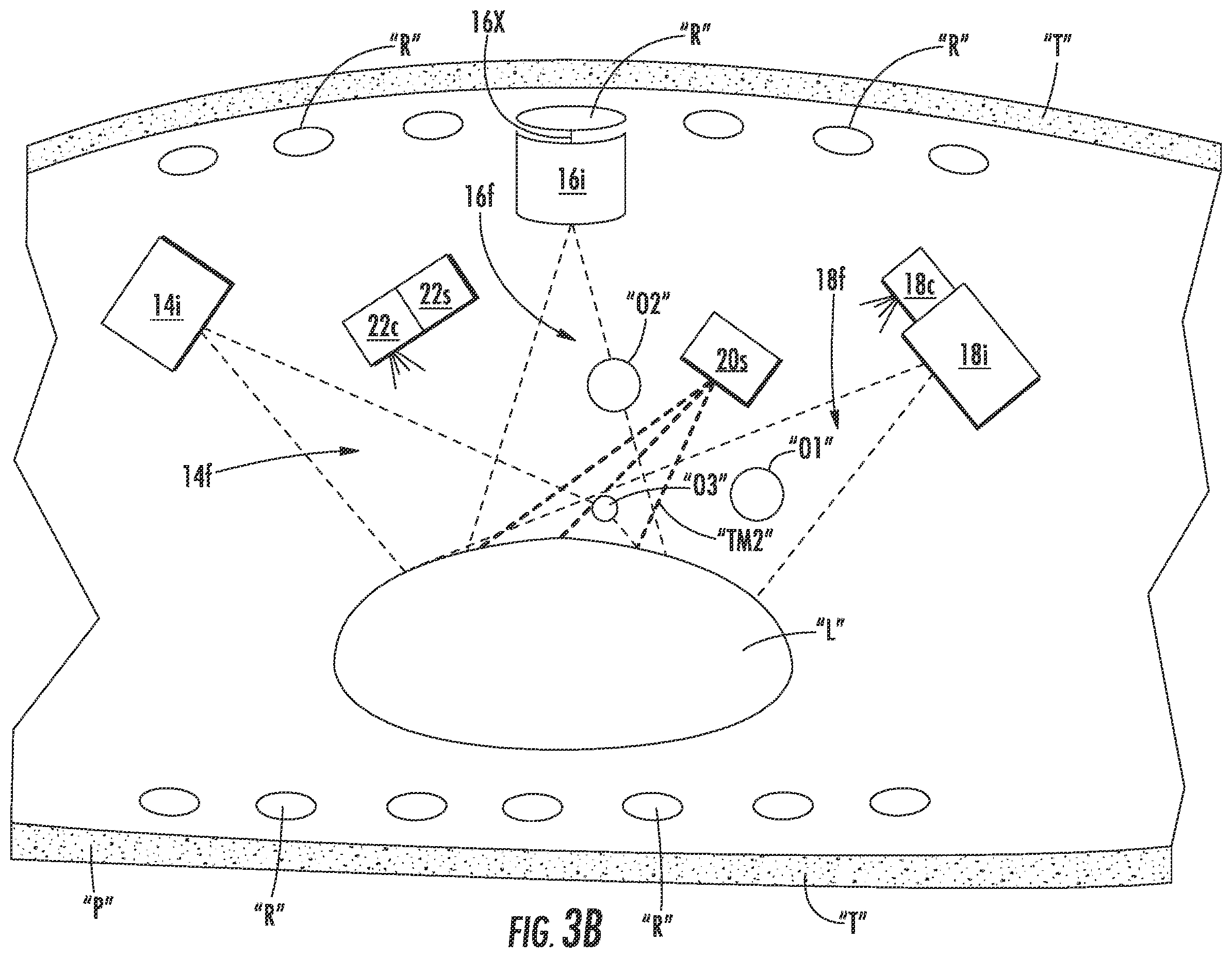 Patent US11793390 Figure 4 – Endoscopic imaging with augmented parallax
