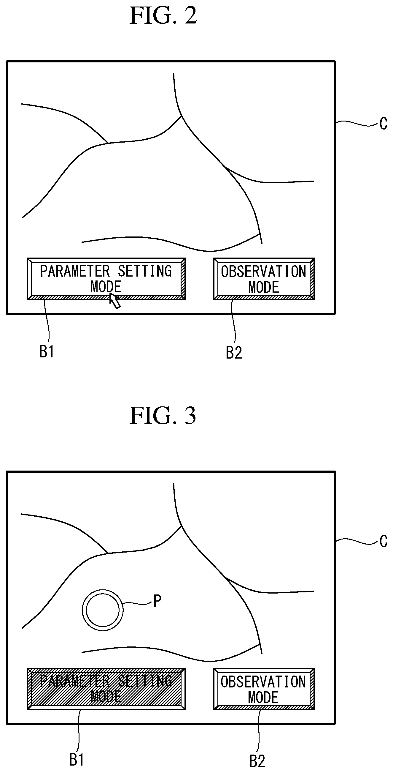 Patent US11793391 Figure 2 – Image processing device, image processing method, endoscope system, and endoscope observation method