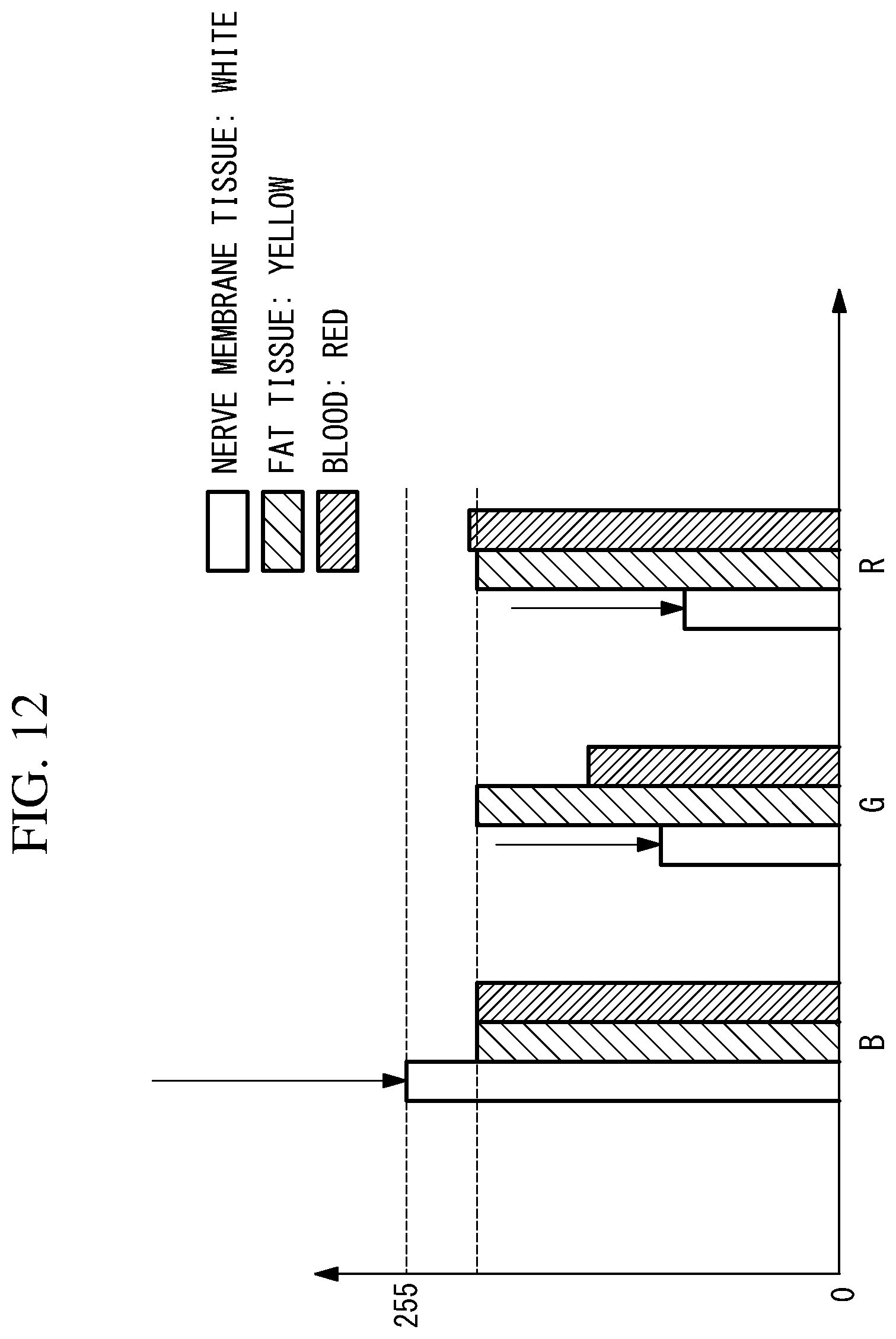 Patent US11793391 Figure 11 – Image processing device, image processing method, endoscope system, and endoscope observation method