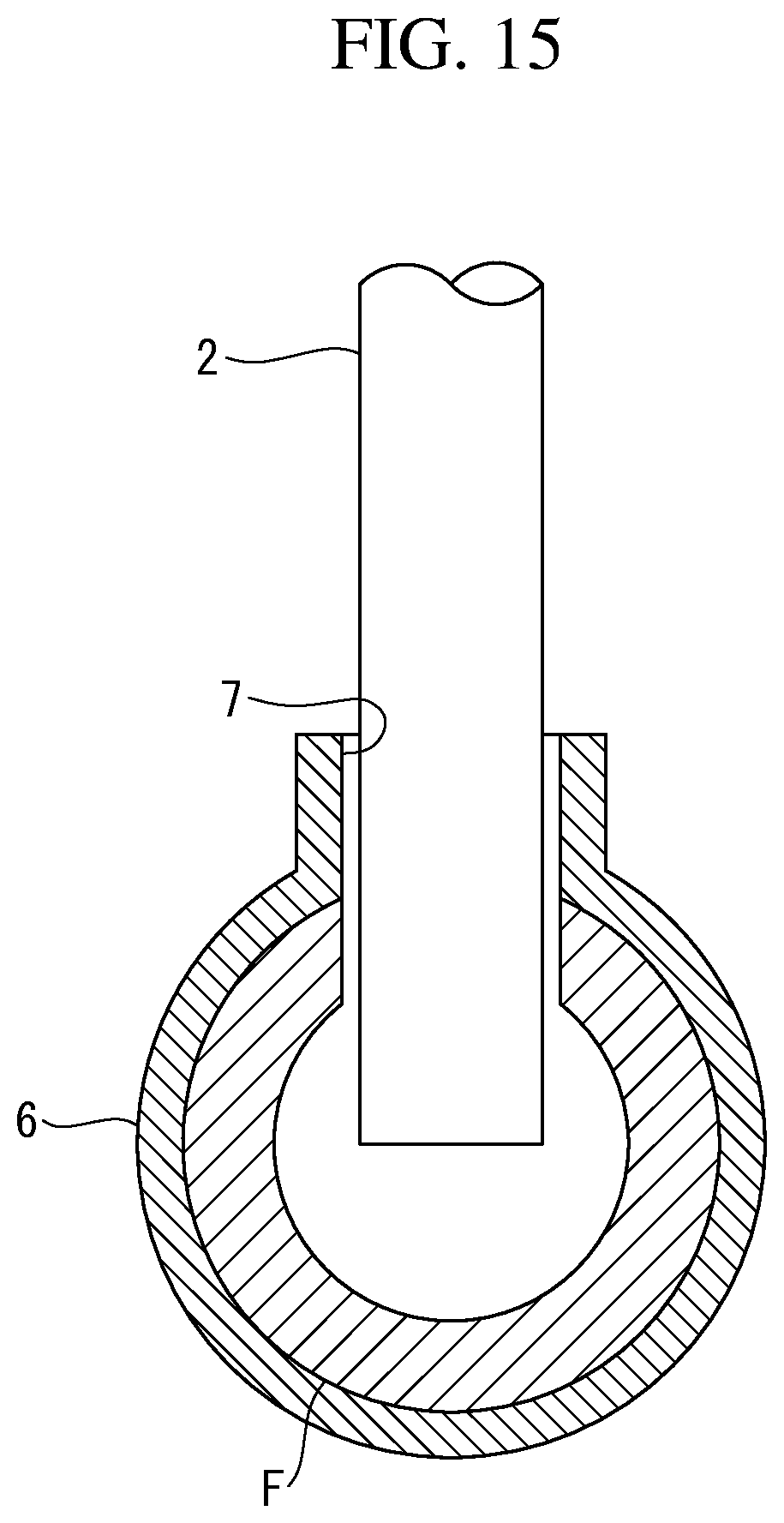 Patent US11793391 Figure 14 – Image processing device, image processing method, endoscope system, and endoscope observation method