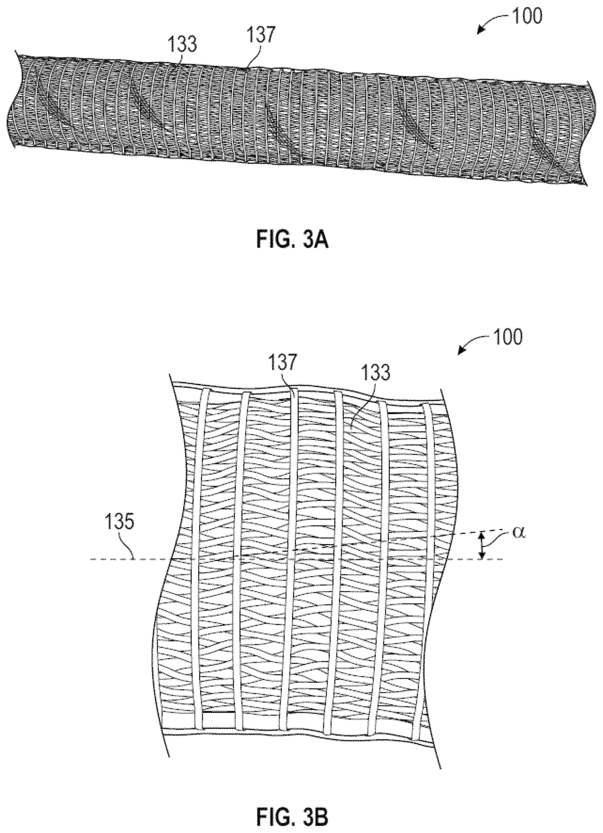 Patent US11793392 Figure 3 – External working channels