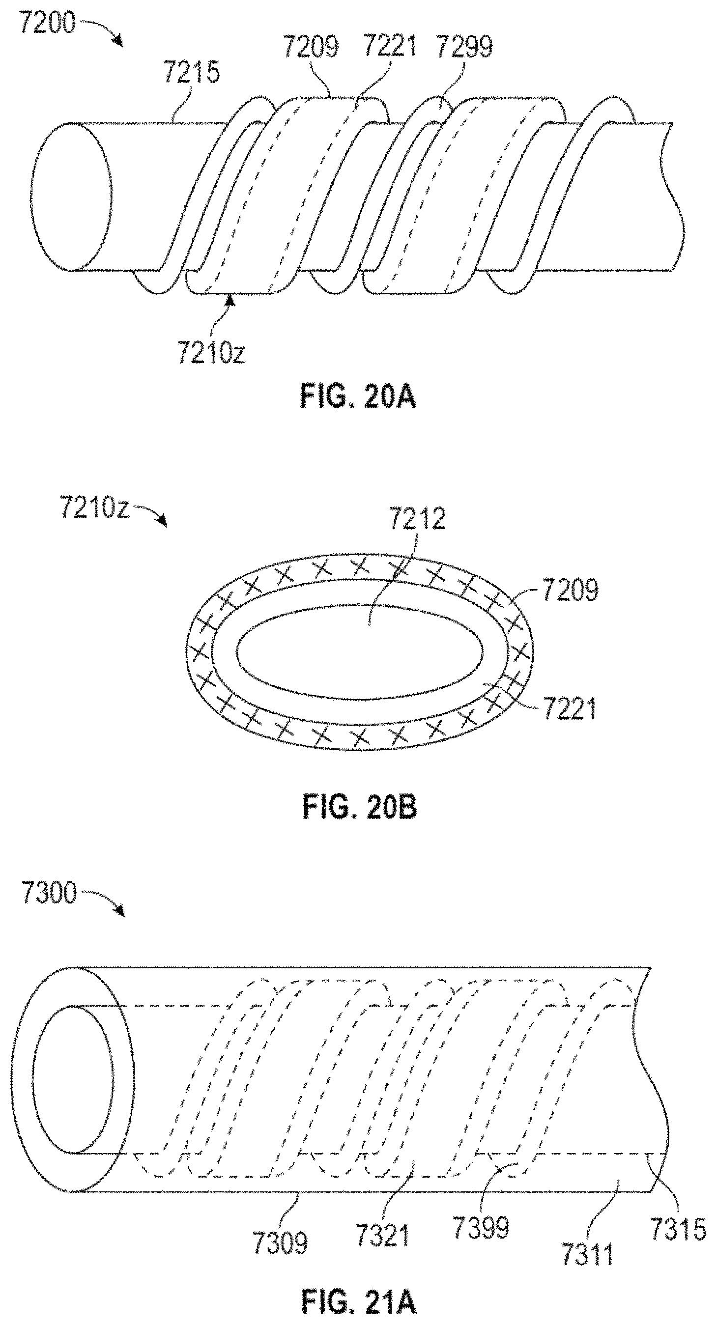 Patent US11793392 Figure 18 – External working channels