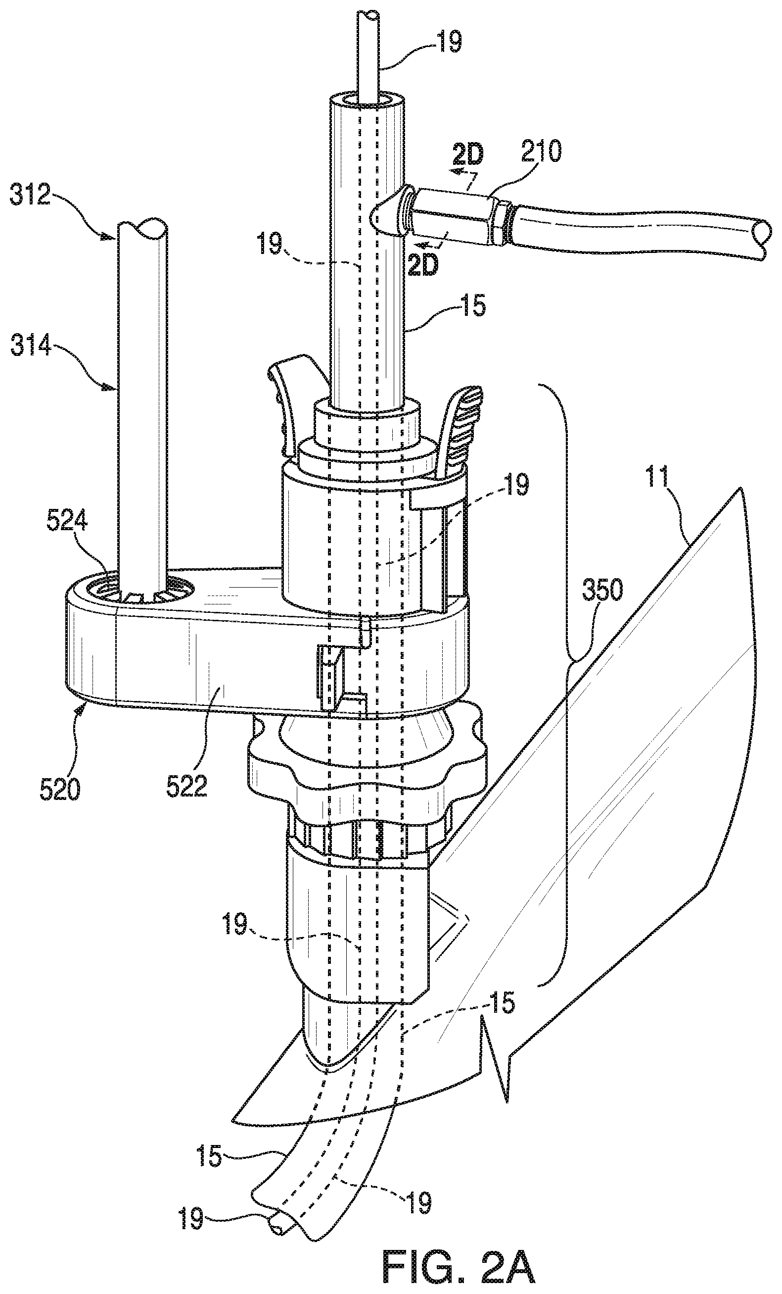 Patent US11793395 Figure 2 – Surgical system having a guide catheter including a fluid passageway