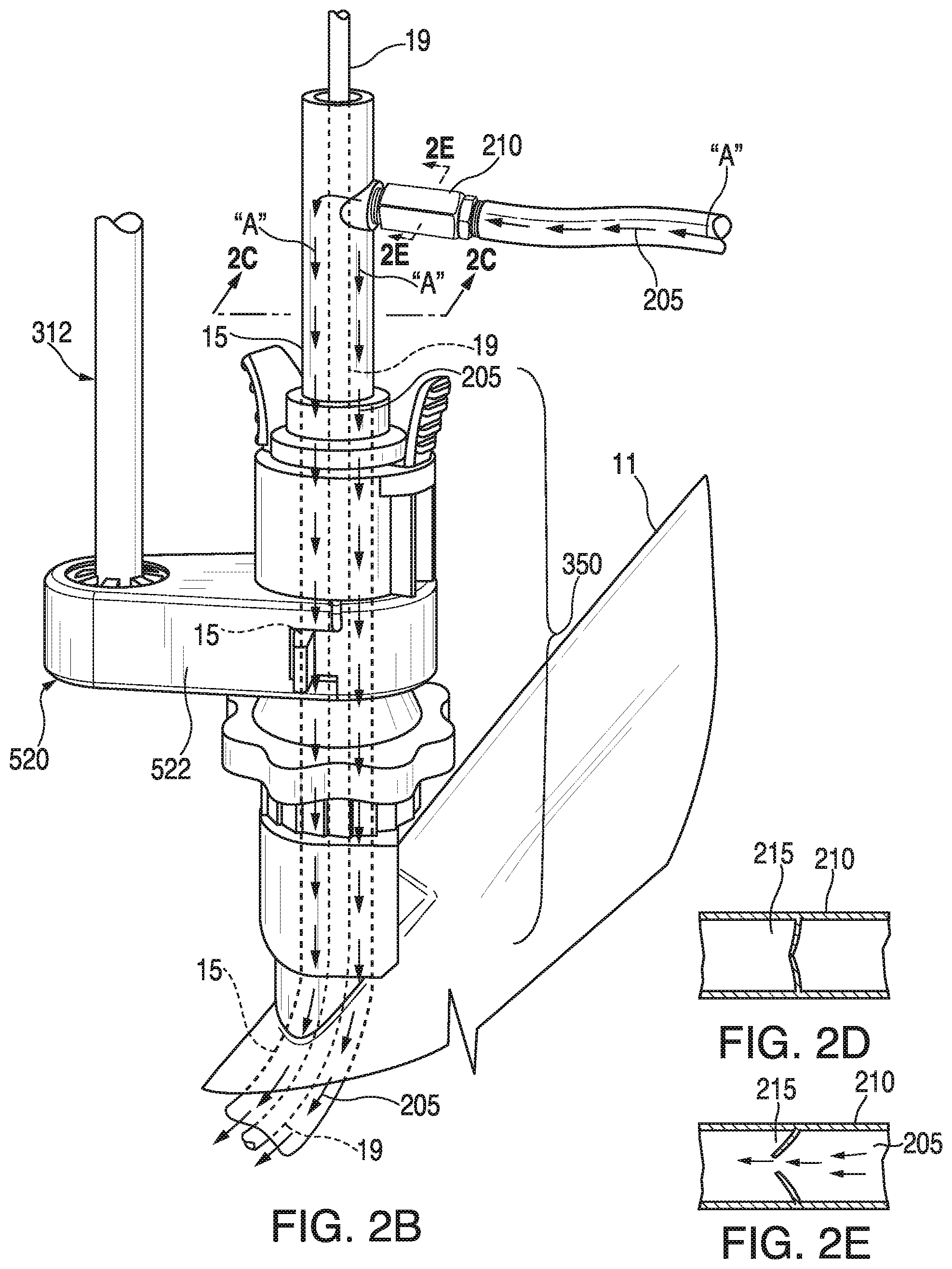 Patent US11793395 Figure 3 – Surgical system having a guide catheter including a fluid passageway