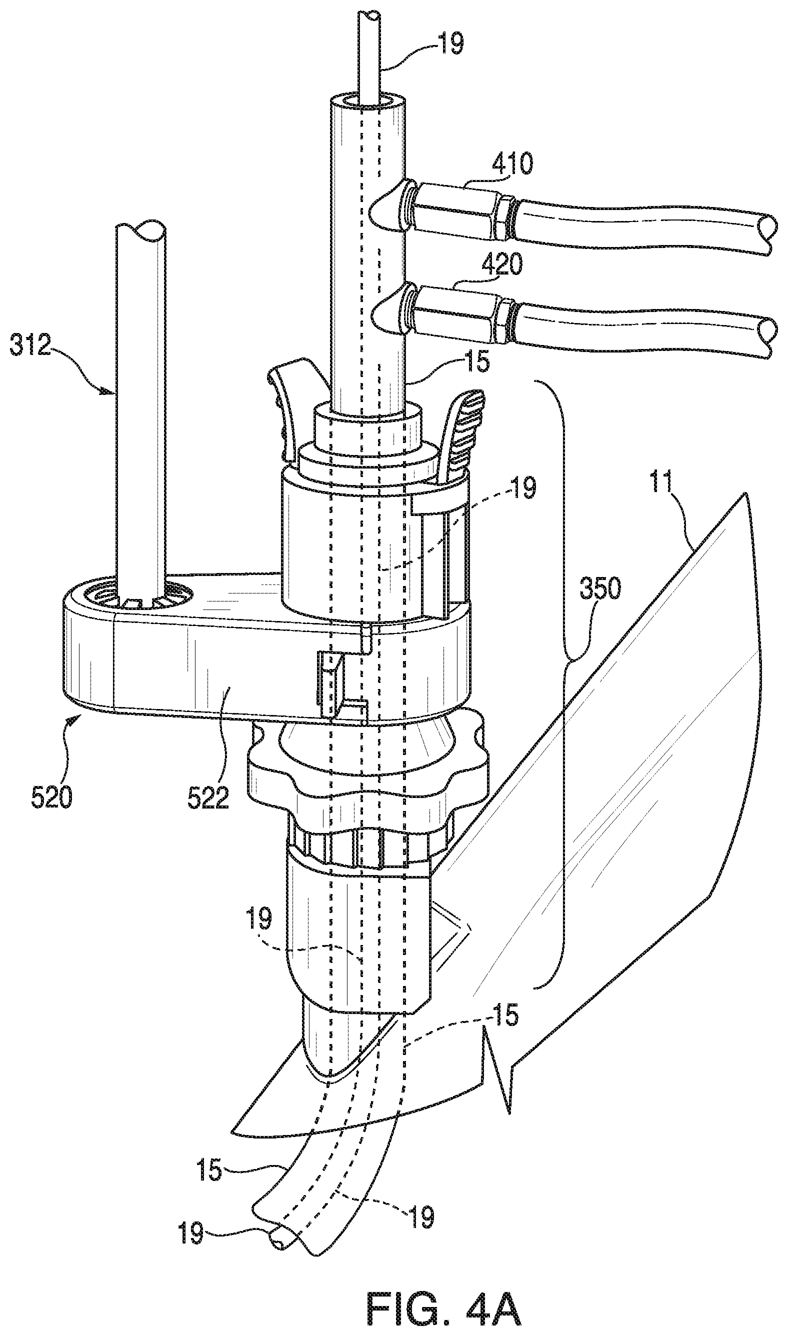 Patent US11793395 Figure 7 – Surgical system having a guide catheter including a fluid passageway