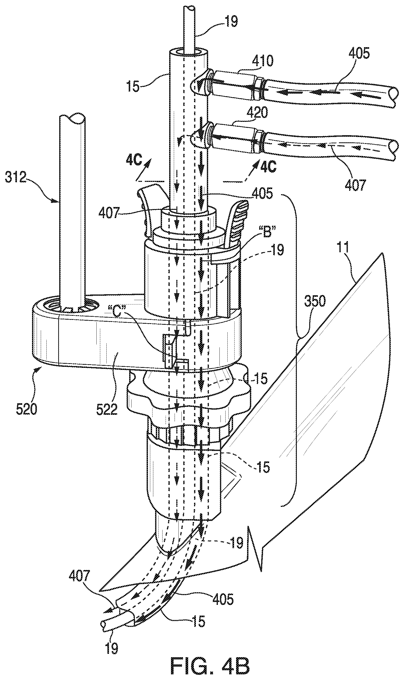Patent US11793395 Figure 8 – Surgical system having a guide catheter including a fluid passageway