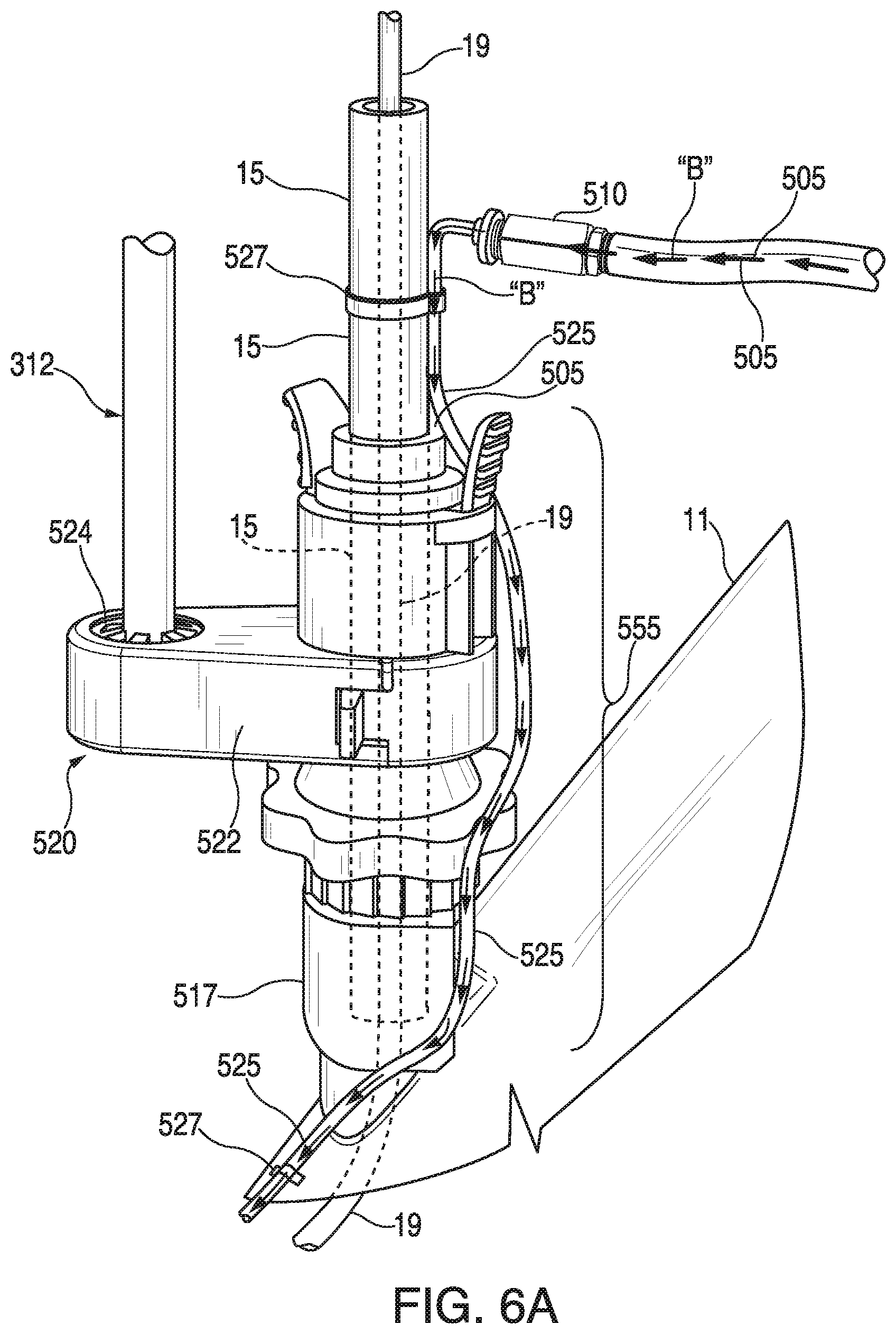 Patent US11793395 Figure 10 – Surgical system having a guide catheter including a fluid passageway