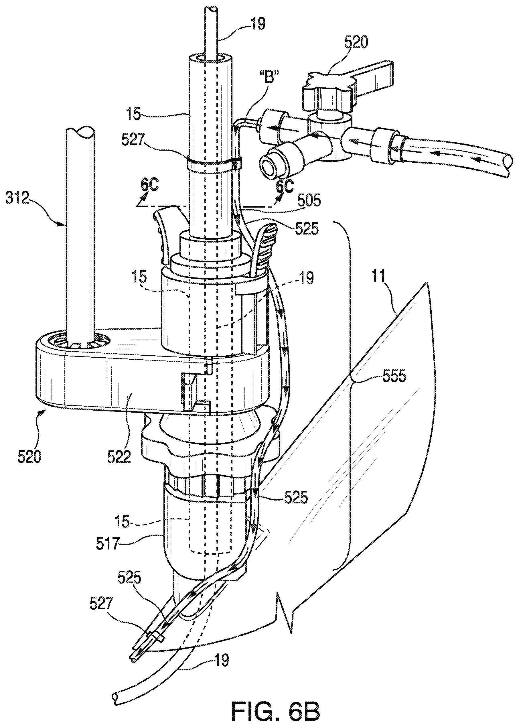 Patent US11793395 Figure 11 – Surgical system having a guide catheter including a fluid passageway