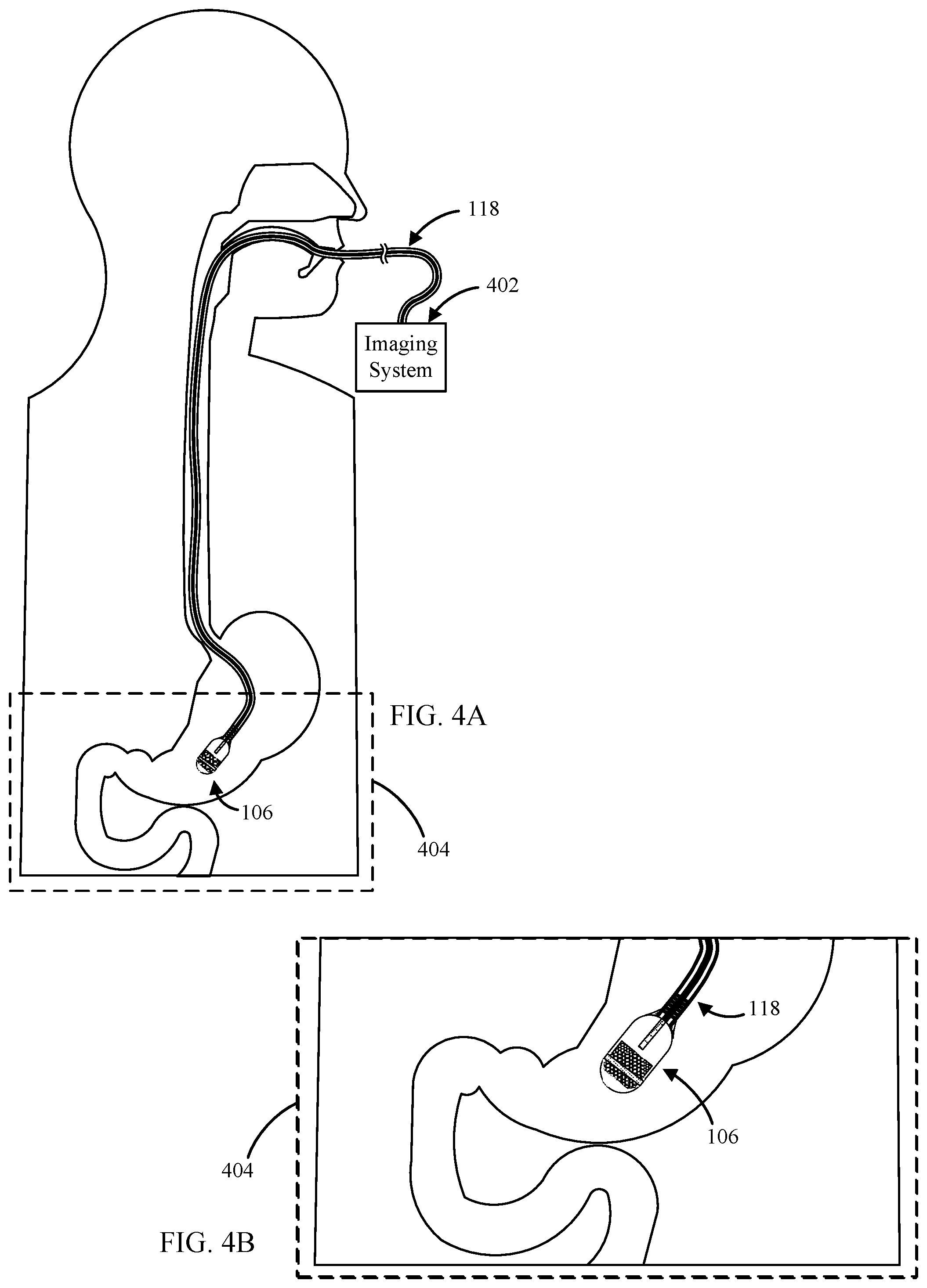Patent US11793396 Figure 3 – Devices, systems, and methods for advancing and positioning tethered capsule microendoscopes