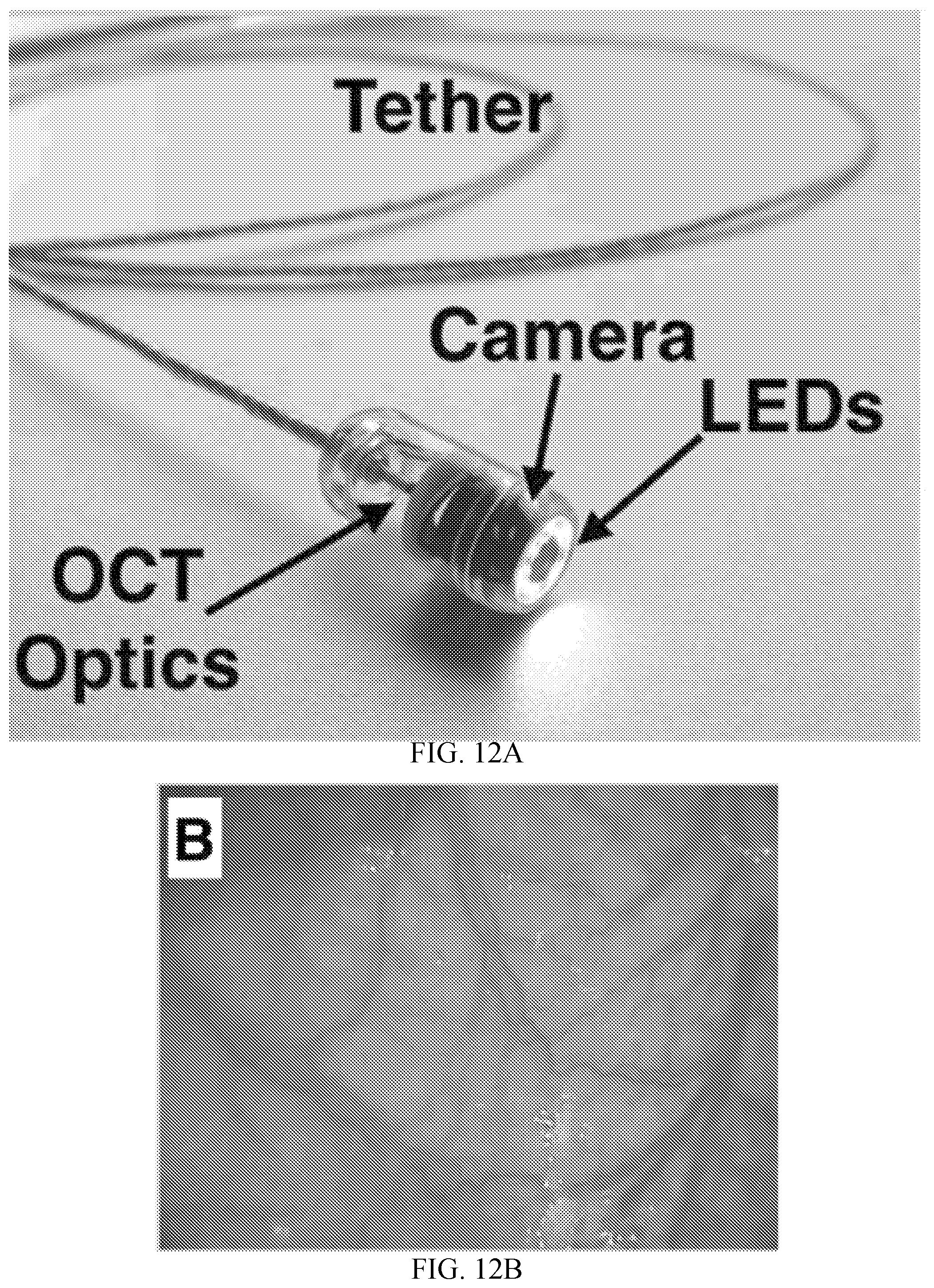 Patent US11793396 Figure 11 – Devices, systems, and methods for advancing and positioning tethered capsule microendoscopes