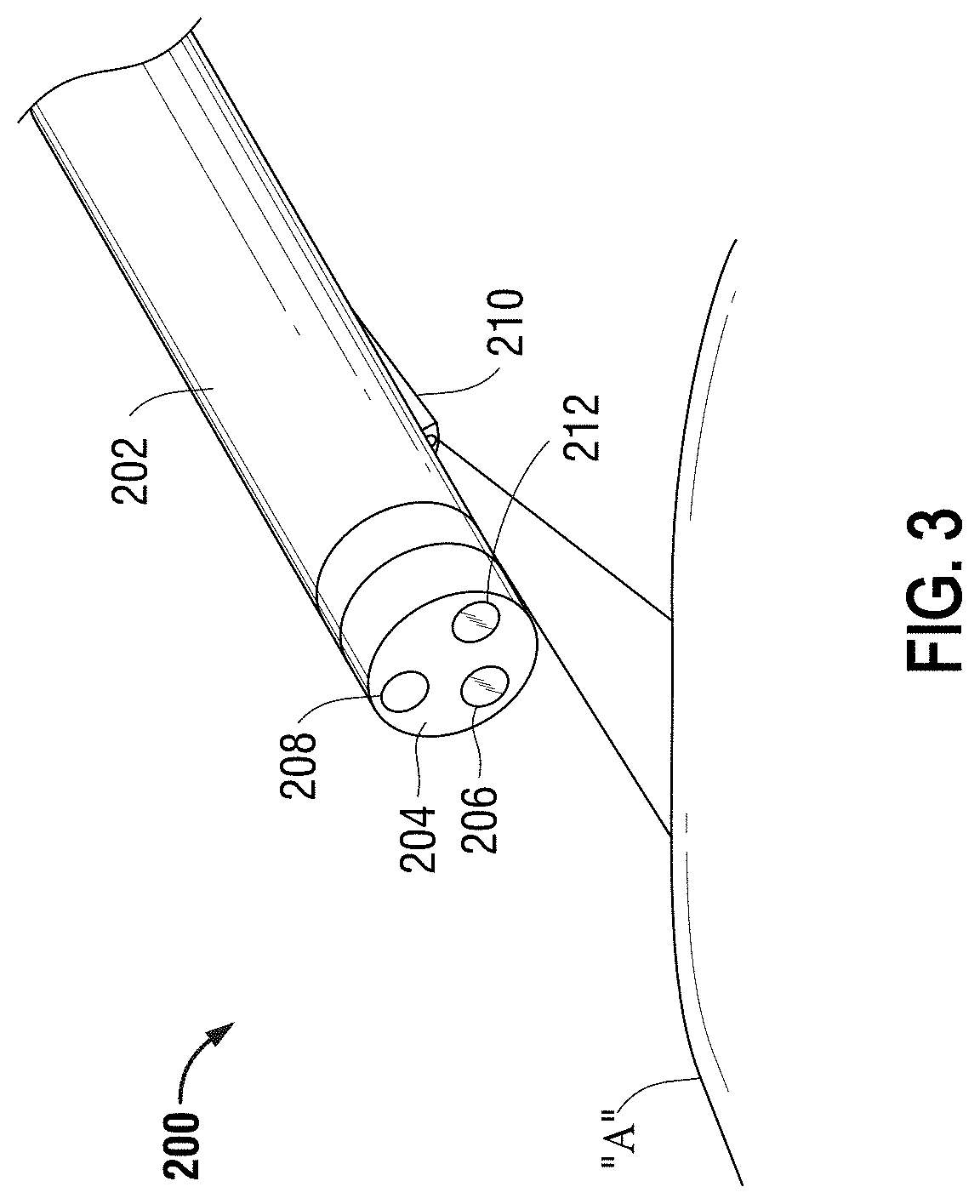 Patent US11793402 Figure 3 – System and method for generating a three-dimensional model of a surgical site